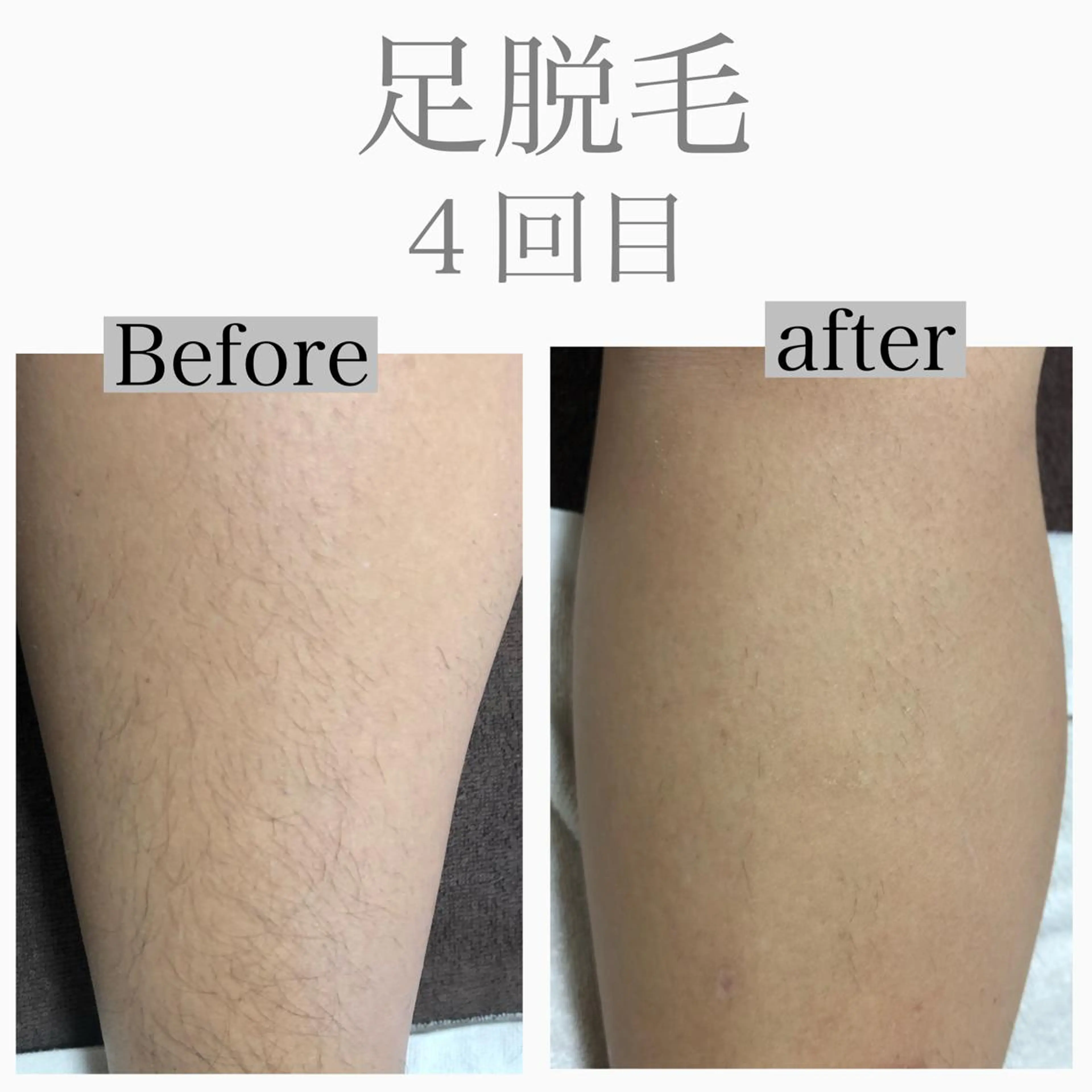 美肌脱毛と癒しのﾌﾟﾗｲﾍﾞｰﾄｻﾛﾝ。gratia~ｸﾞﾚｲﾃｨｱ~所属・gratia ~ｸﾞﾚｲﾃｨｱ~のエステ・リラクイメージ