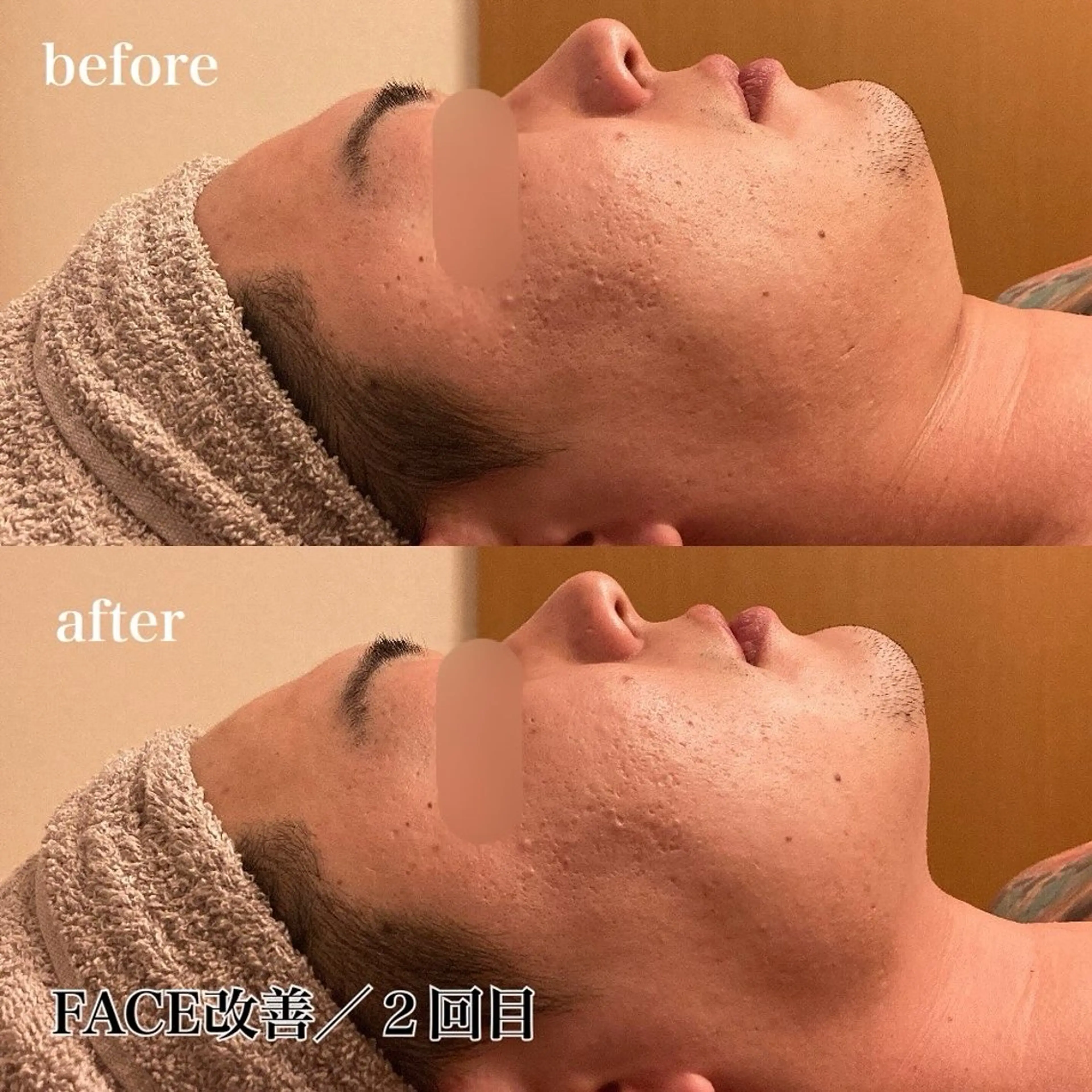 磐田｜LAYLA 一番丁寧な脱毛店のエステ・リラクイメージ