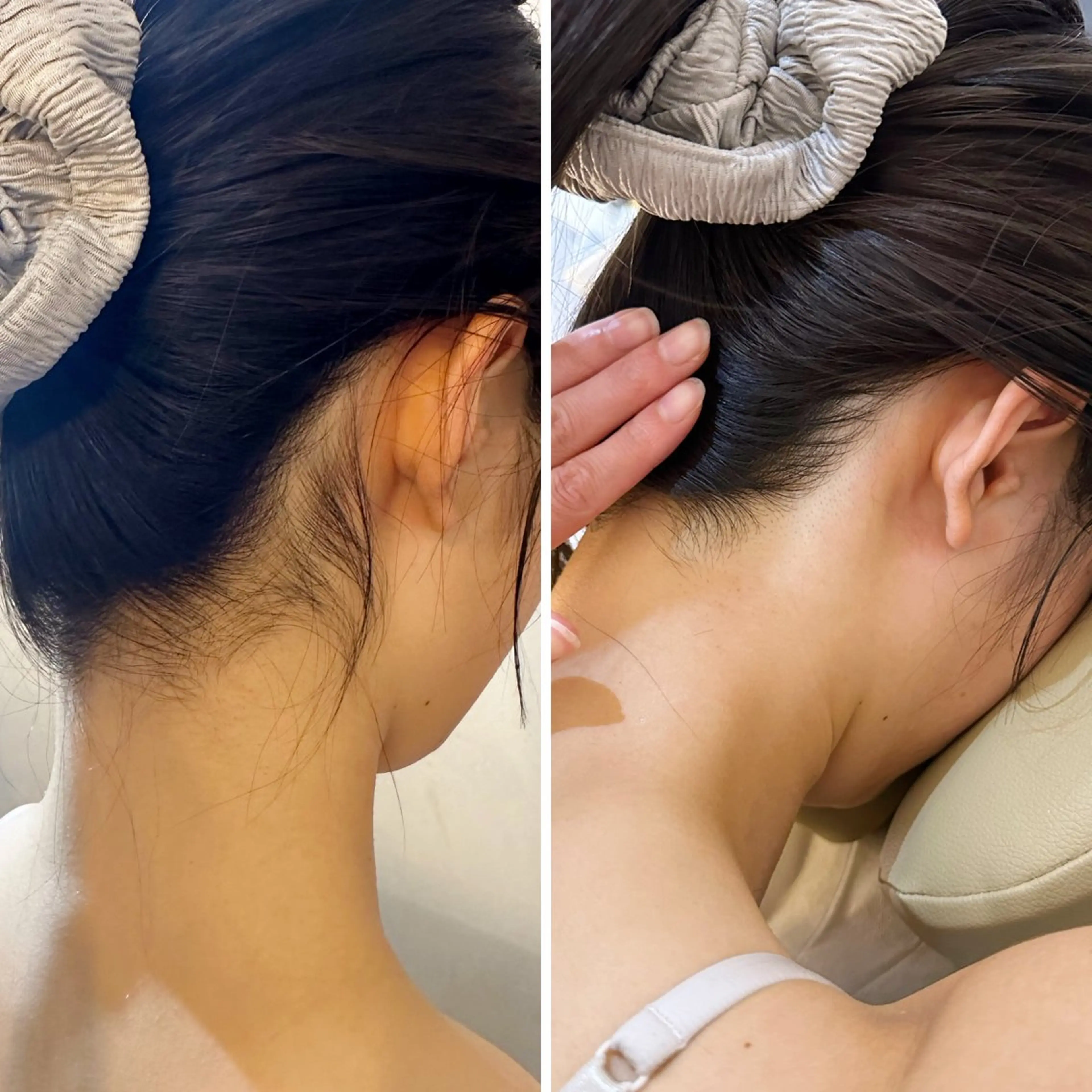 脱毛 うなじ脱毛/美肌脱毛 LABELのエステ・リラクイメージ