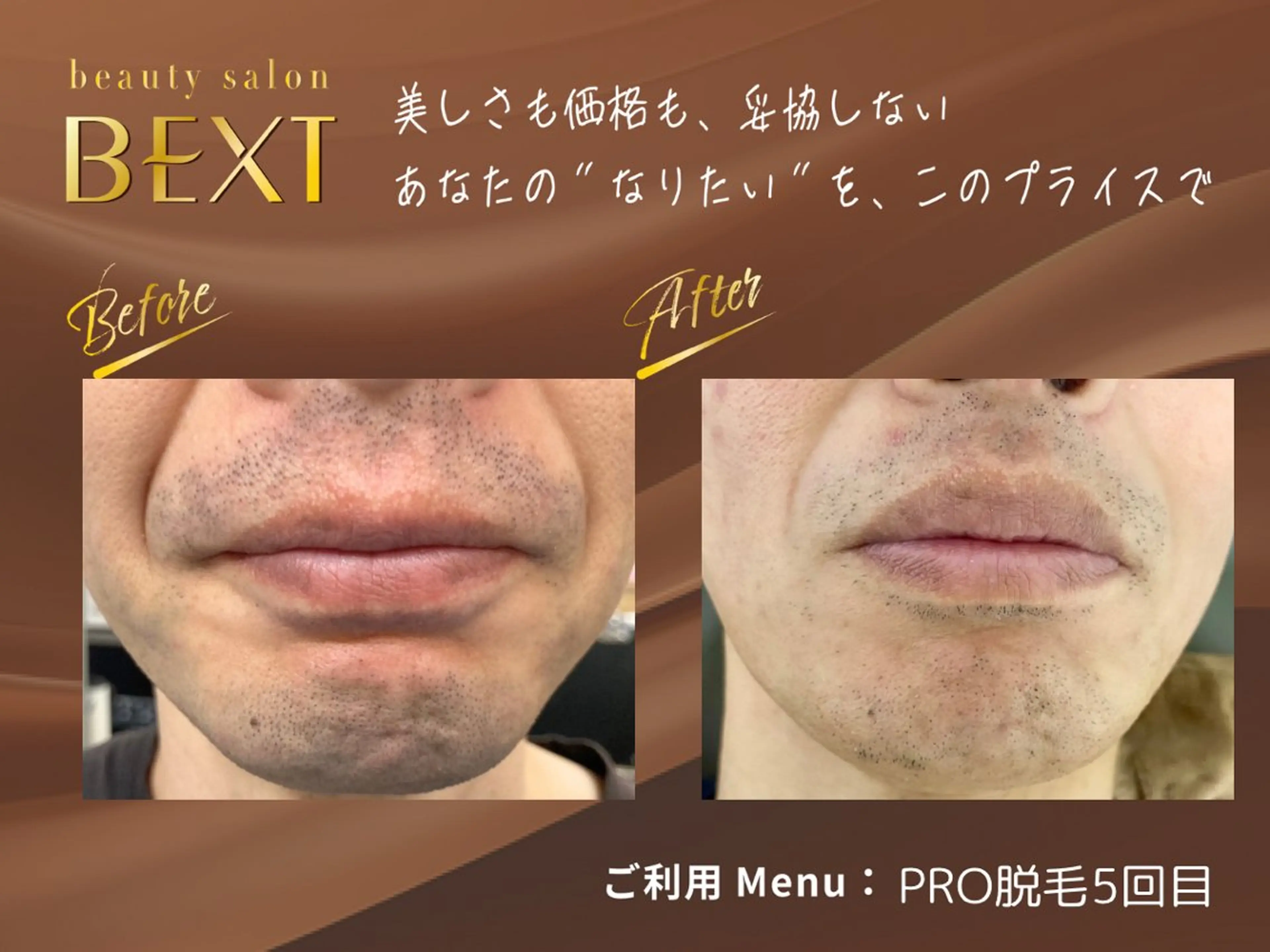 メンズ 脱毛 ビューティーサロンベクスト beautysalonBEXT所属・ビューティーサロン ベクスト名古屋のエステ・リラクイメージ