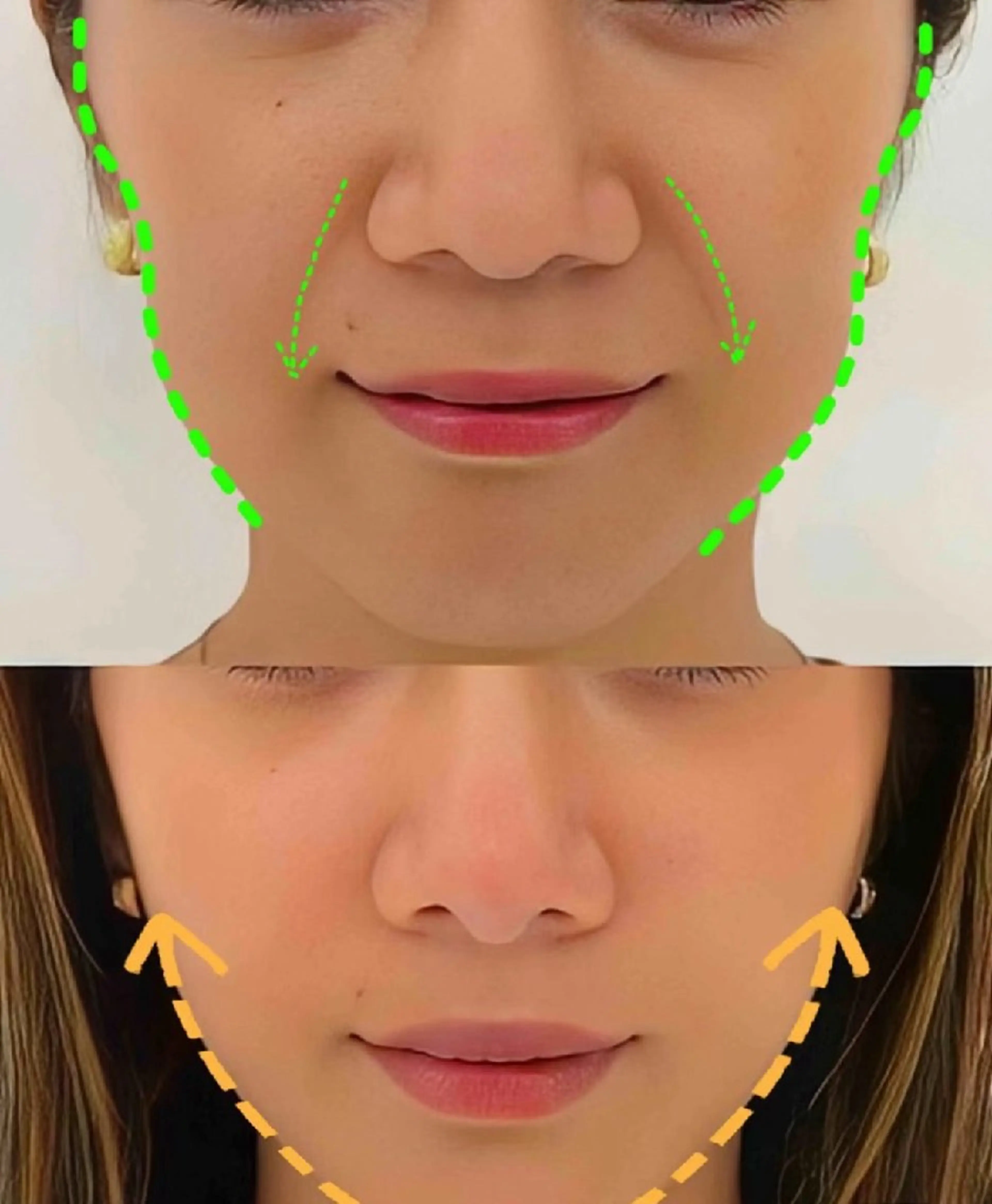 ネイル ホワイト aliaハイフ&水光ジェットサロン所属・aliaハーブ水光店 エステティシャン募集のエステ・リラクイメージ