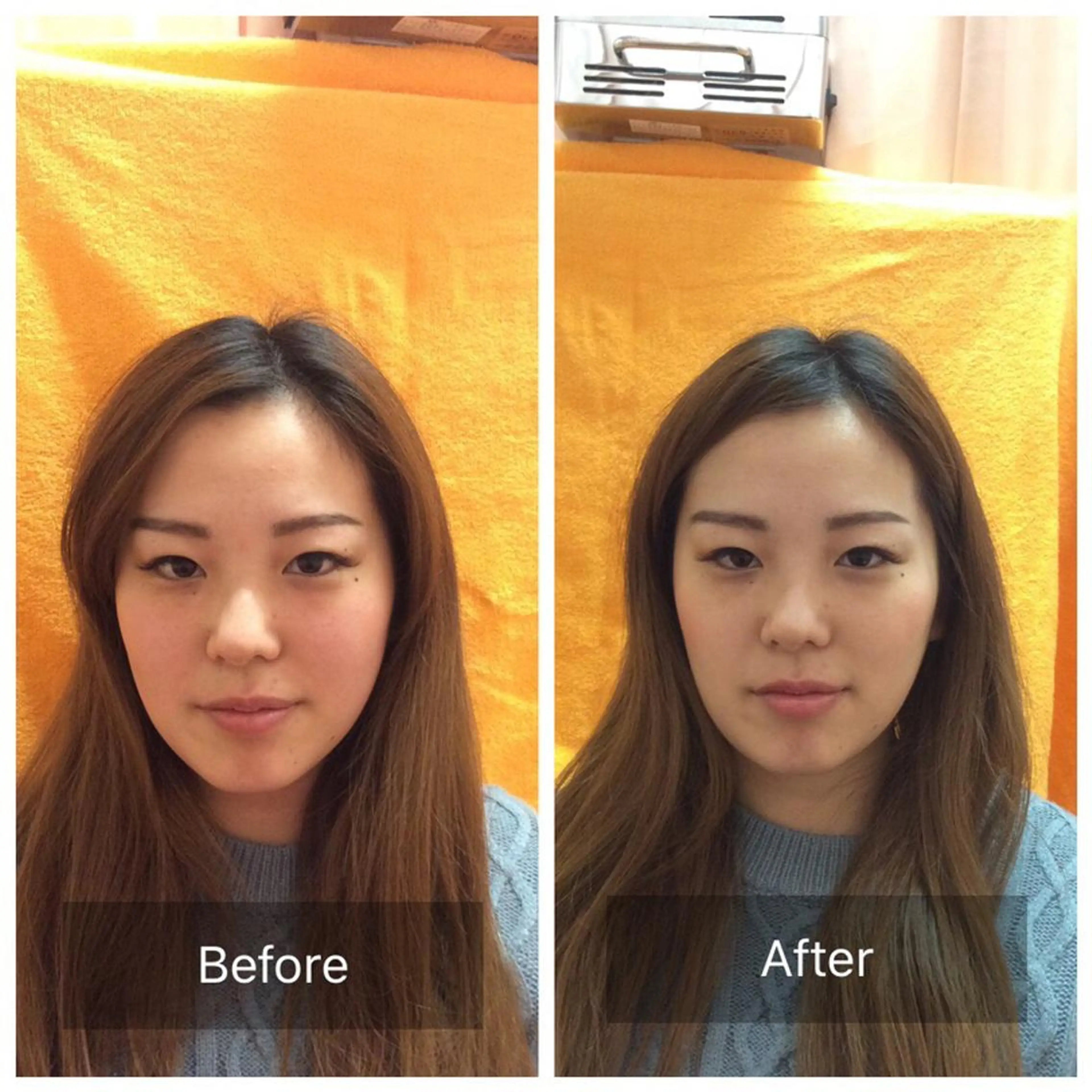 美容鍼・整体 根本改善/小林幸司のエステ・リラクイメージ