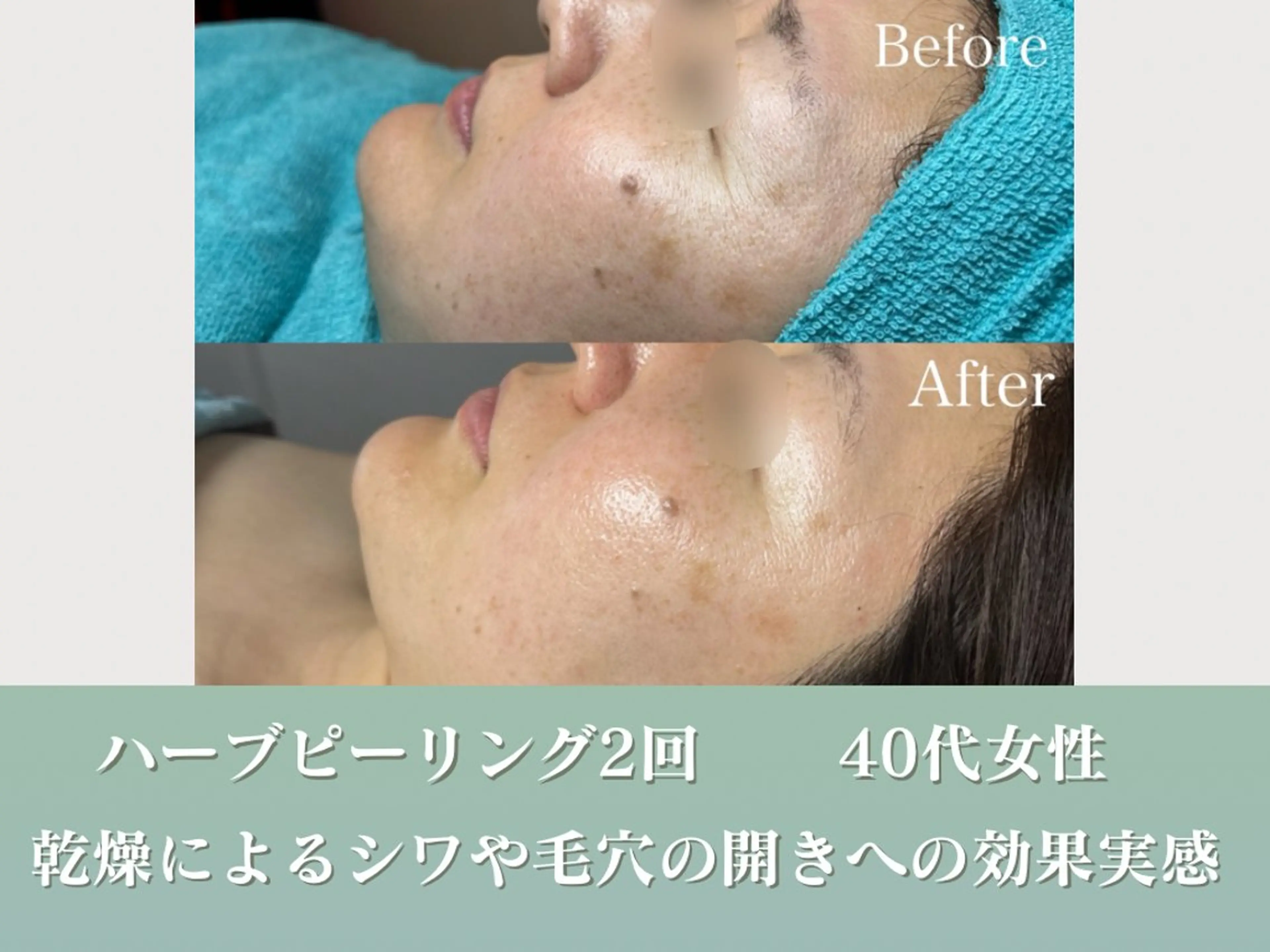 潤い艶肌／肌質改善 YUKAのエステ・リラクイメージ