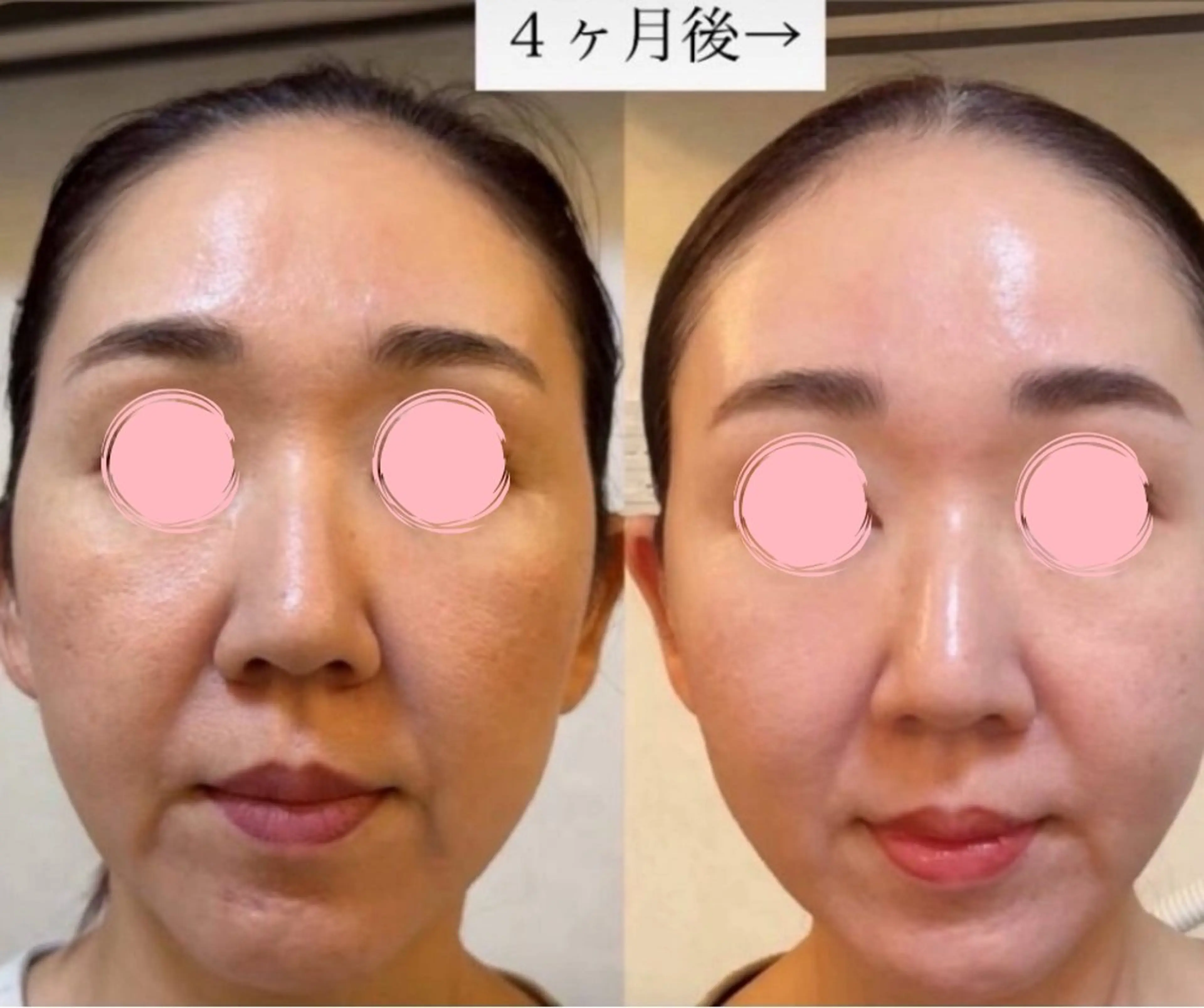 エステ 辻村 晴美のエステ・リラクイメージ