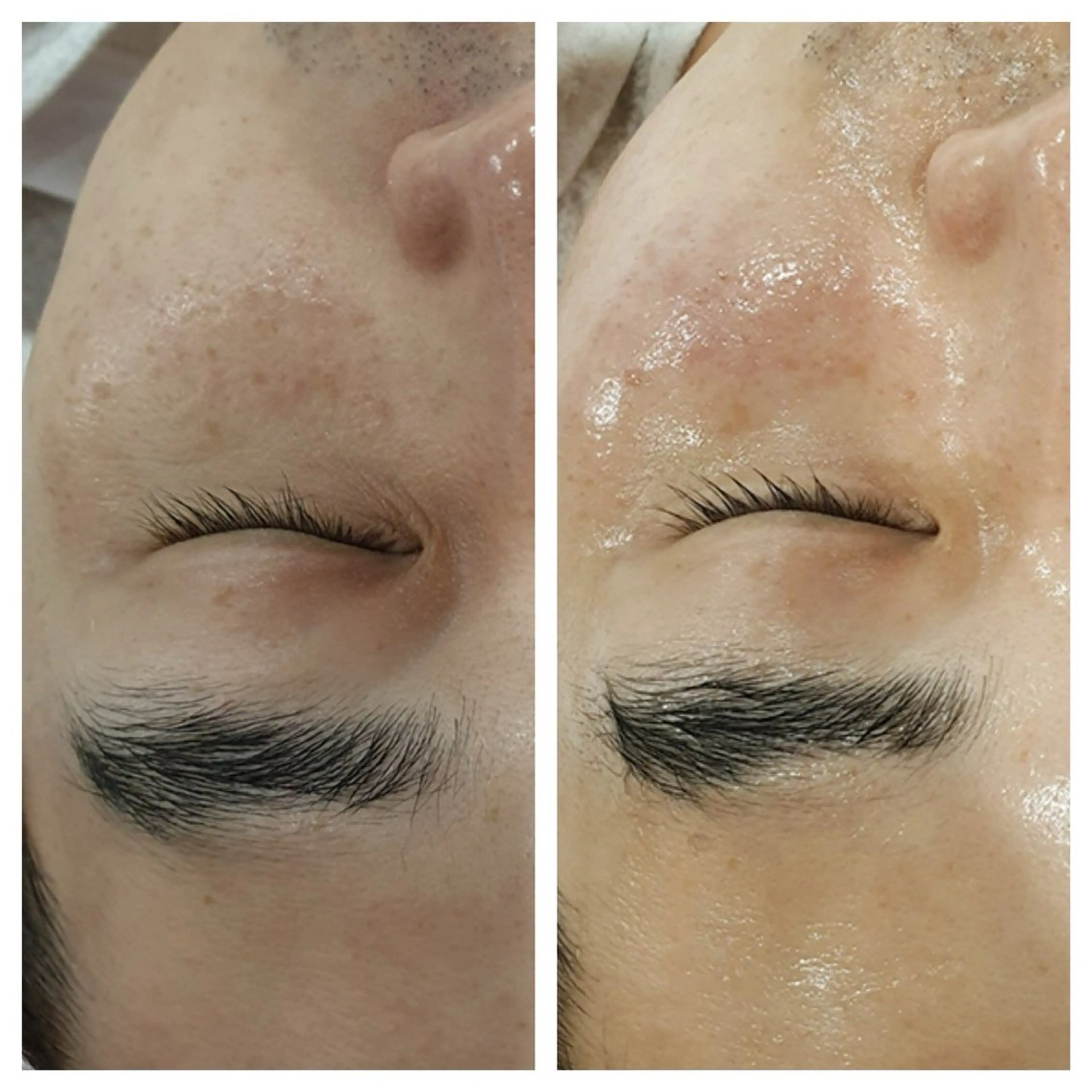 表参道鍼灸院K 美容鍼🔮ララピールのエステ・リラクイメージ