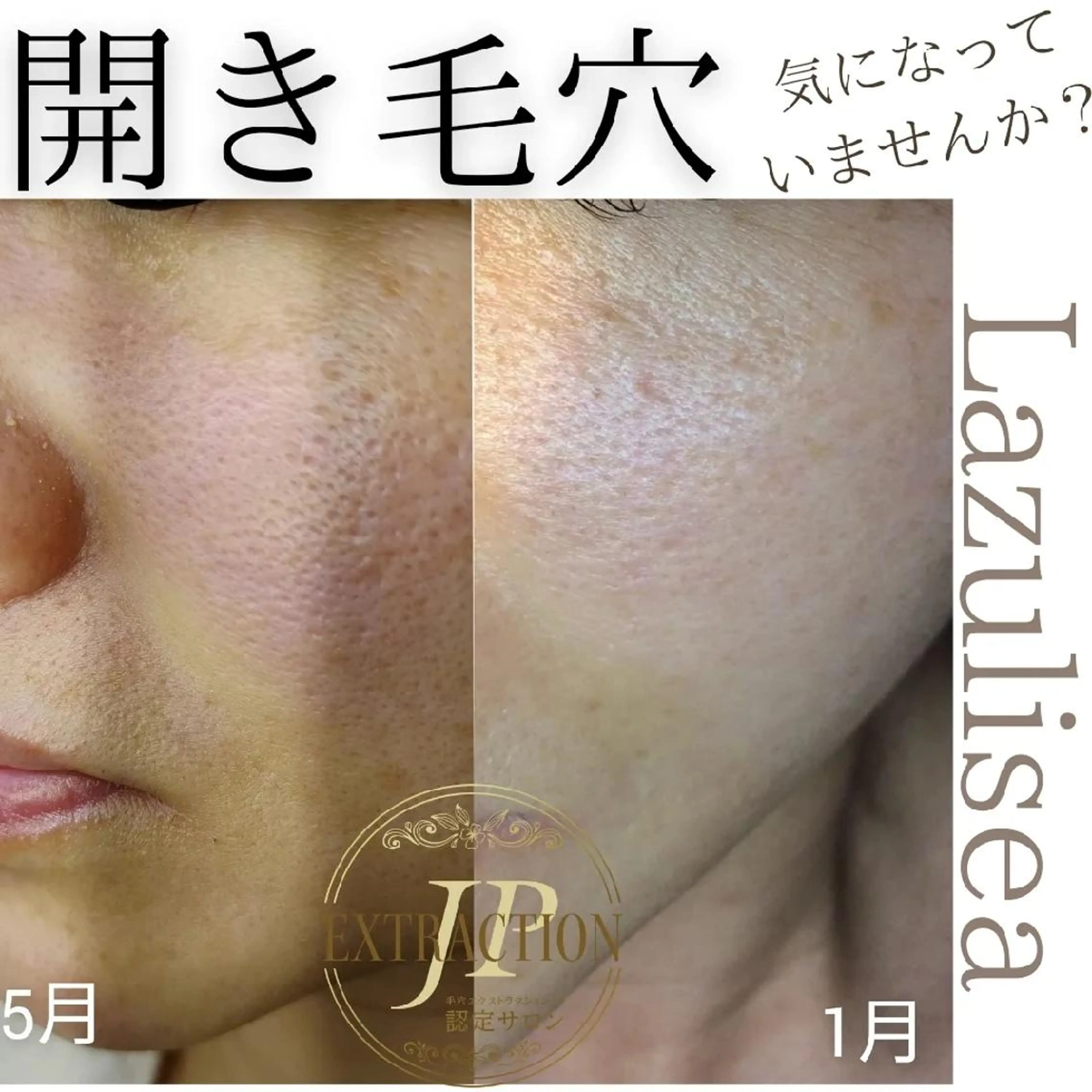 エステサロン Lazulisea所属・川口 春奈のエステ・リラクイメージ