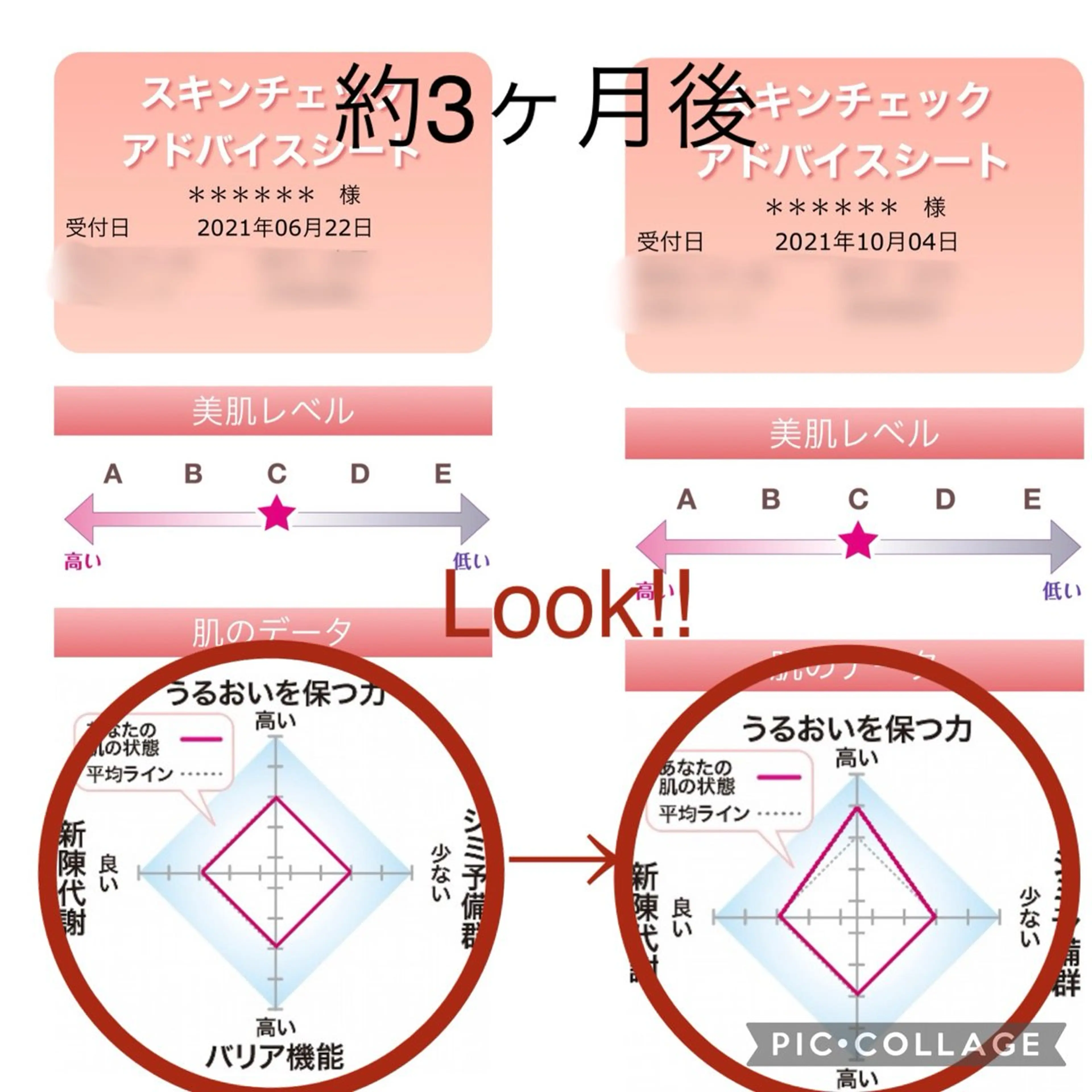 スキンチェックの写真