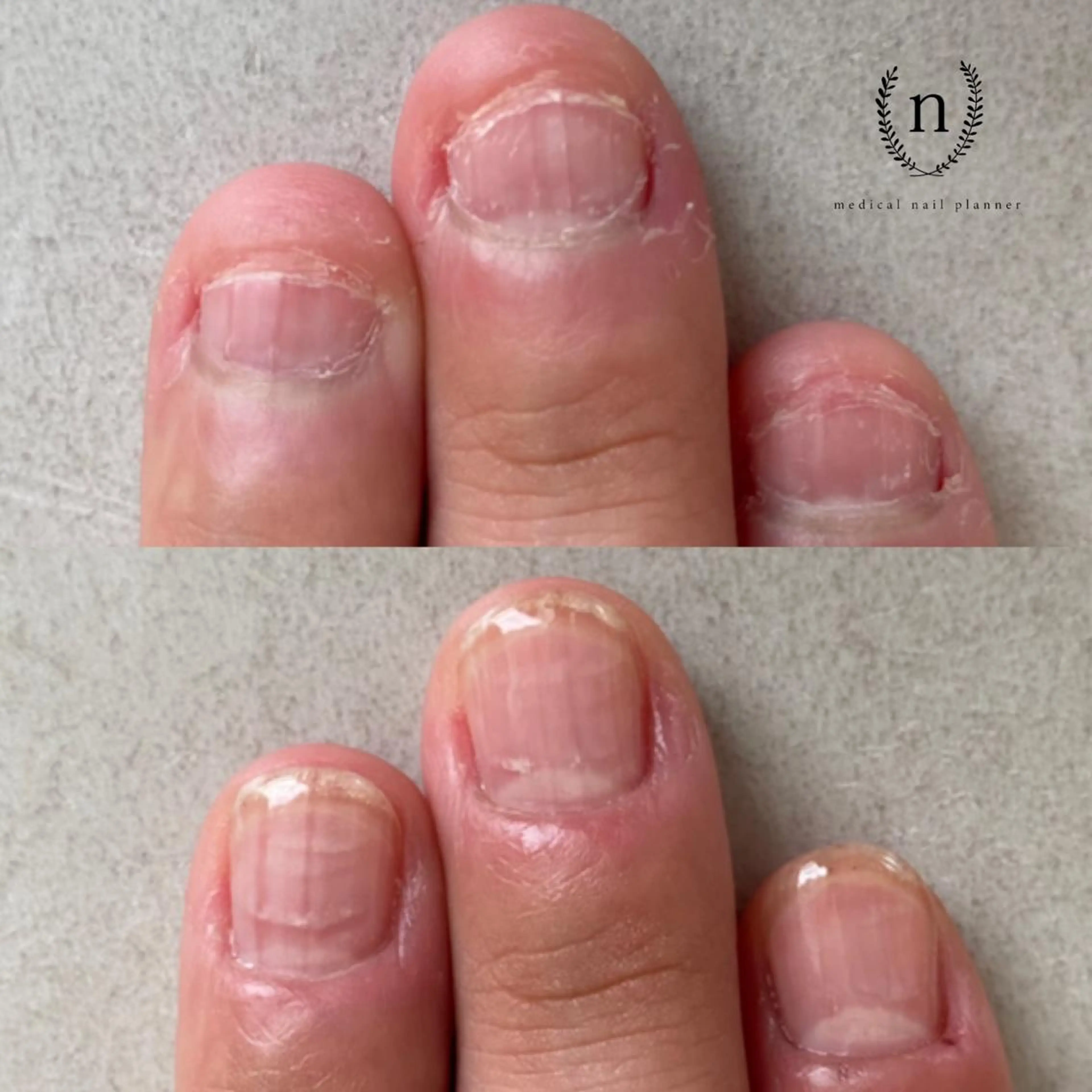 ネイル Rio 𓍼のネイルデザイン