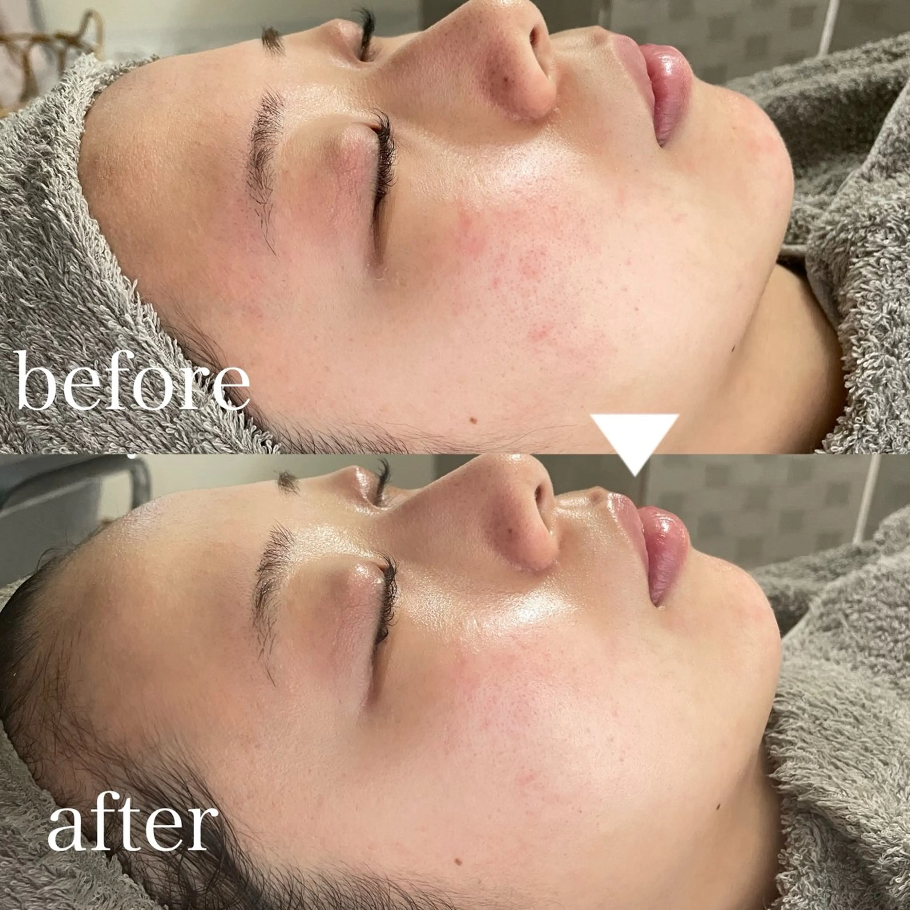 LBSホワイトニング 🌐岡山店のその他イメージ