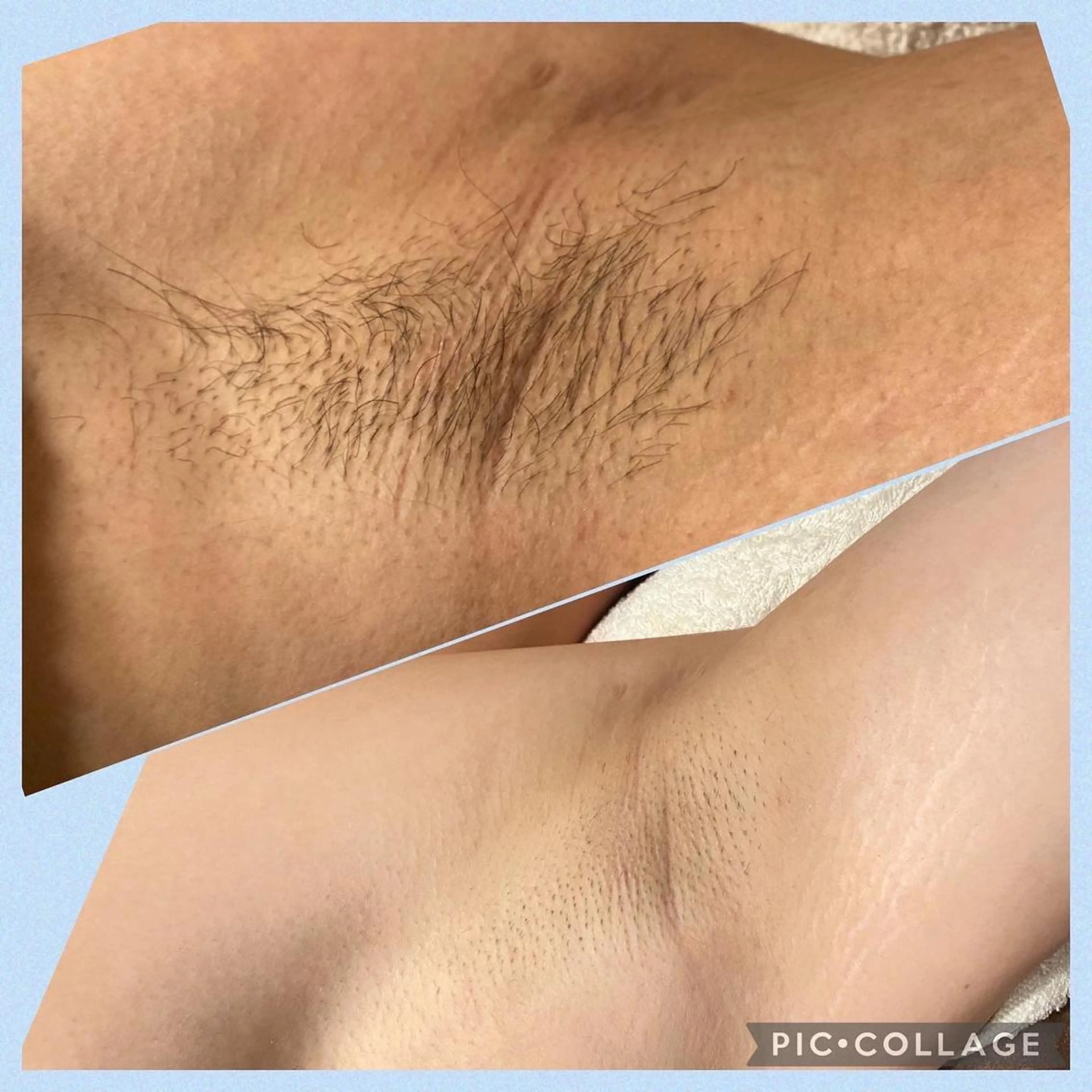 脱毛MAX南越谷所属・脱毛MAX 店長まなみのエステ・リラクイメージ