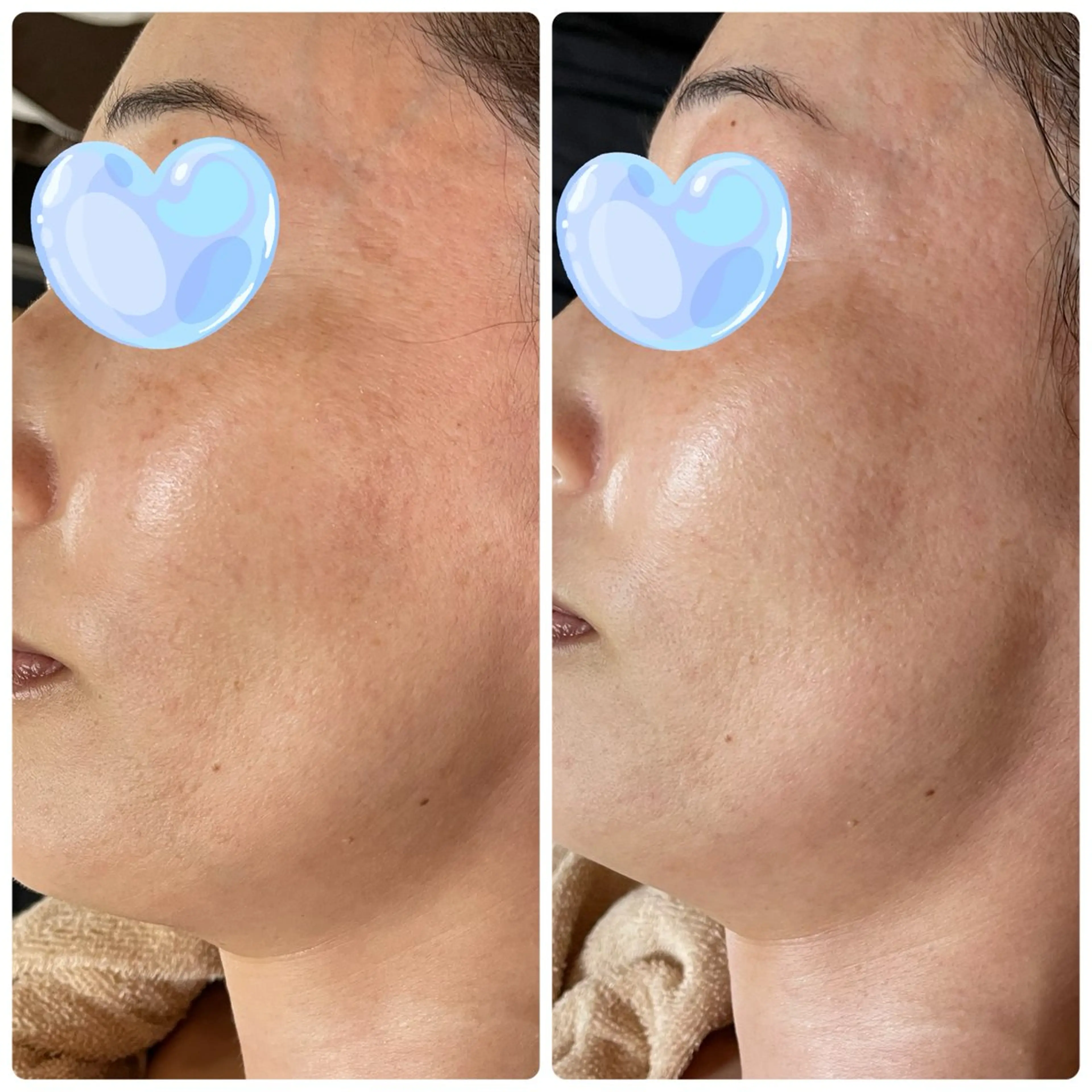 M.riche エムリシェのエステ・リラクイメージ