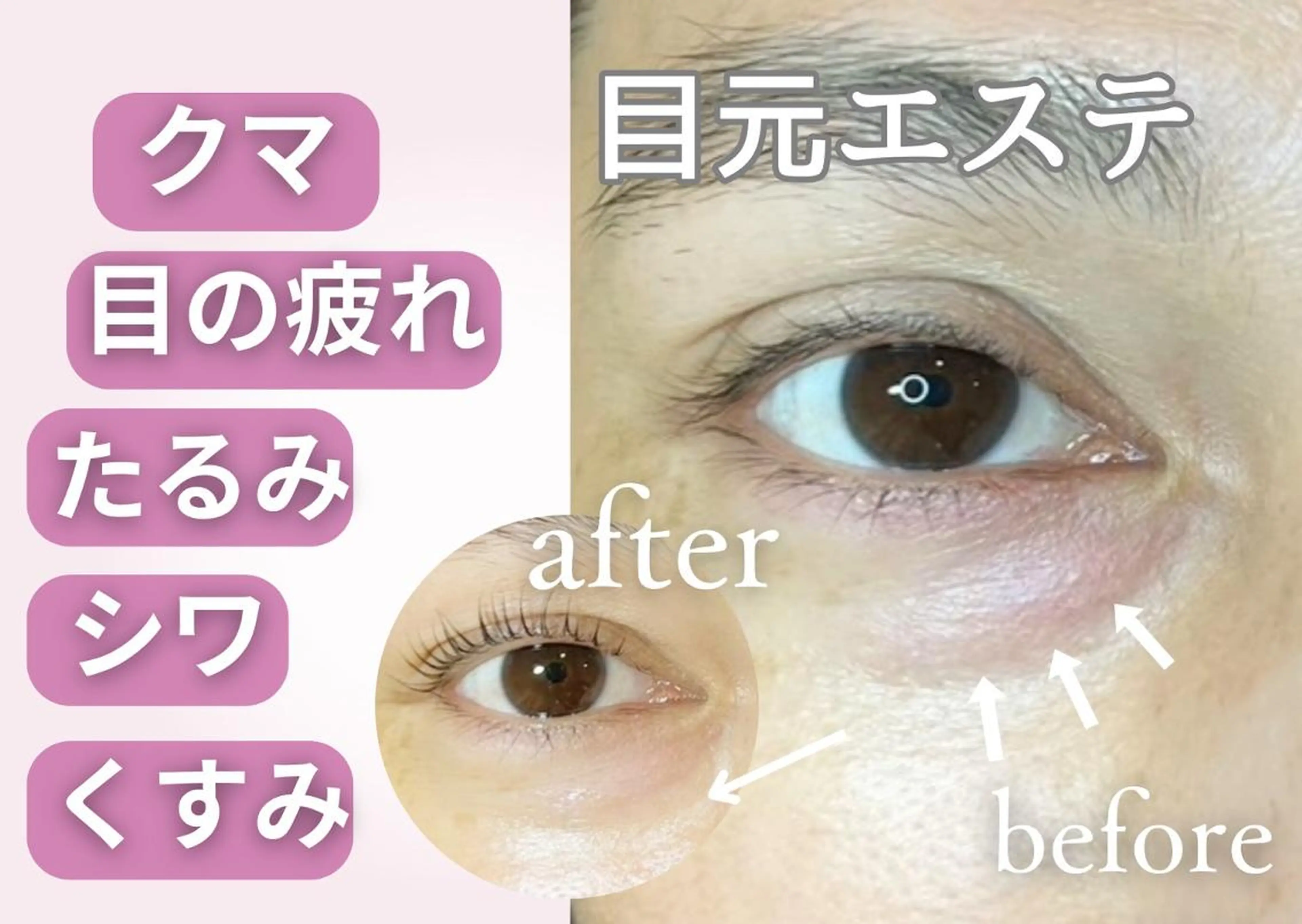 マツエク・マツパ 有村 葉留花のマツエク・マツパデザイン