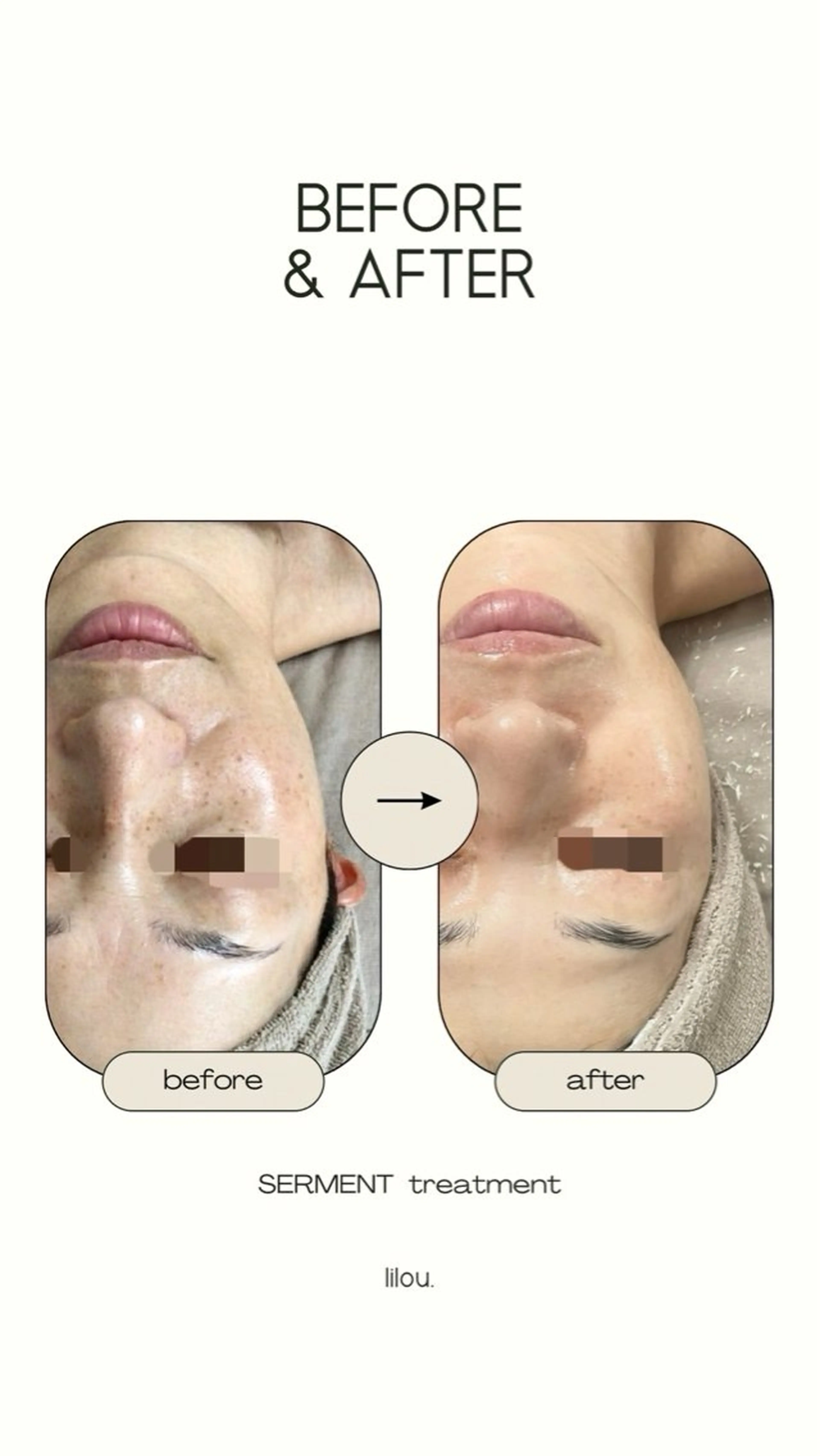 吉田 hue.のエステ・リラクイメージ