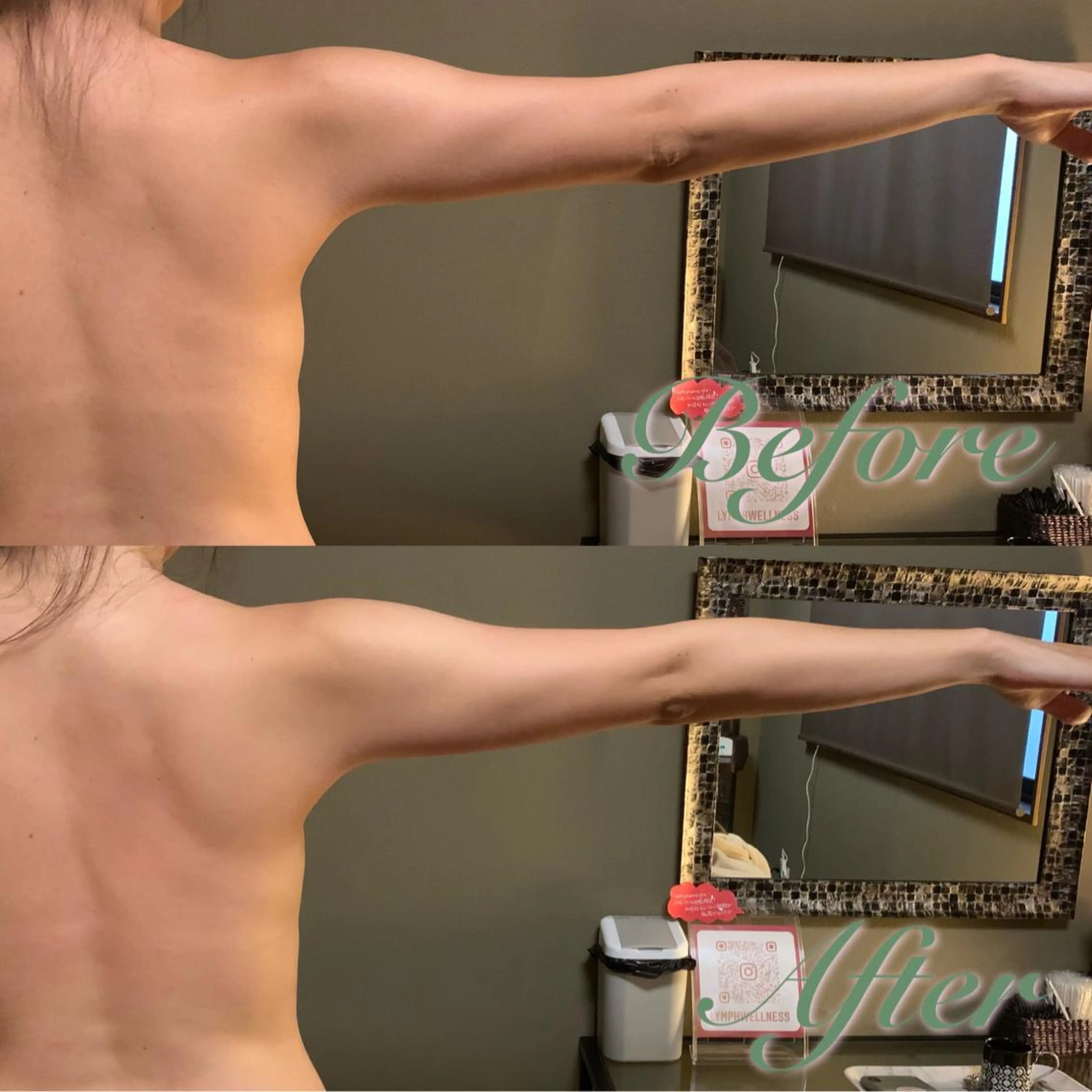 lymph care 'Welnəsのエステ・リラクイメージ