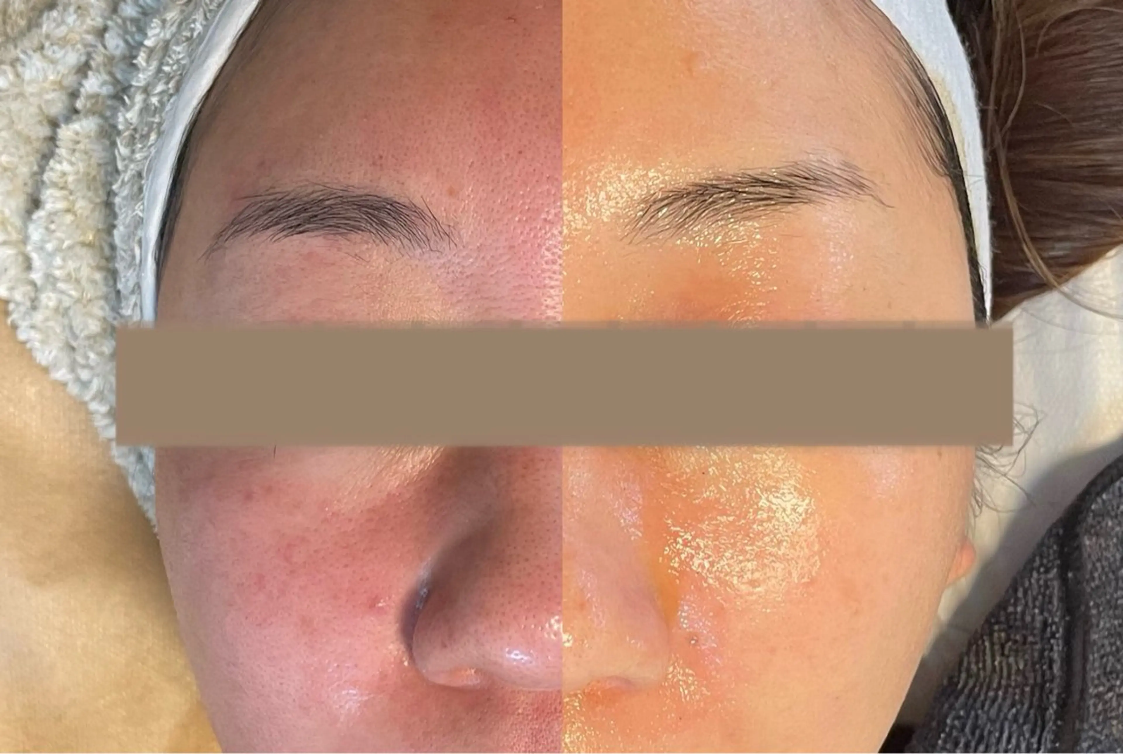 代表 MOMOのエステ・リラクイメージ