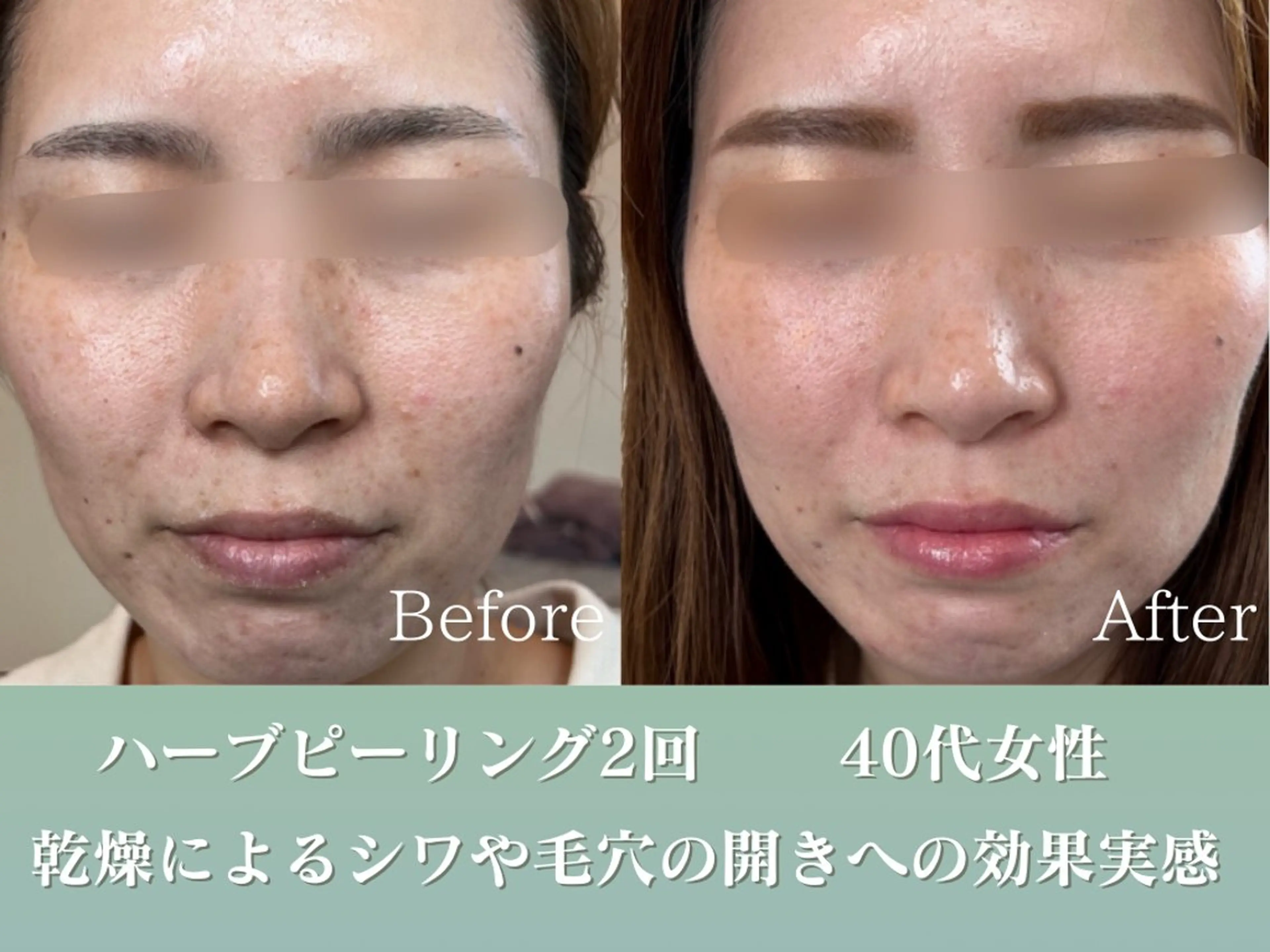 潤い艶肌／肌質改善 YUKAのエステ・リラクイメージ