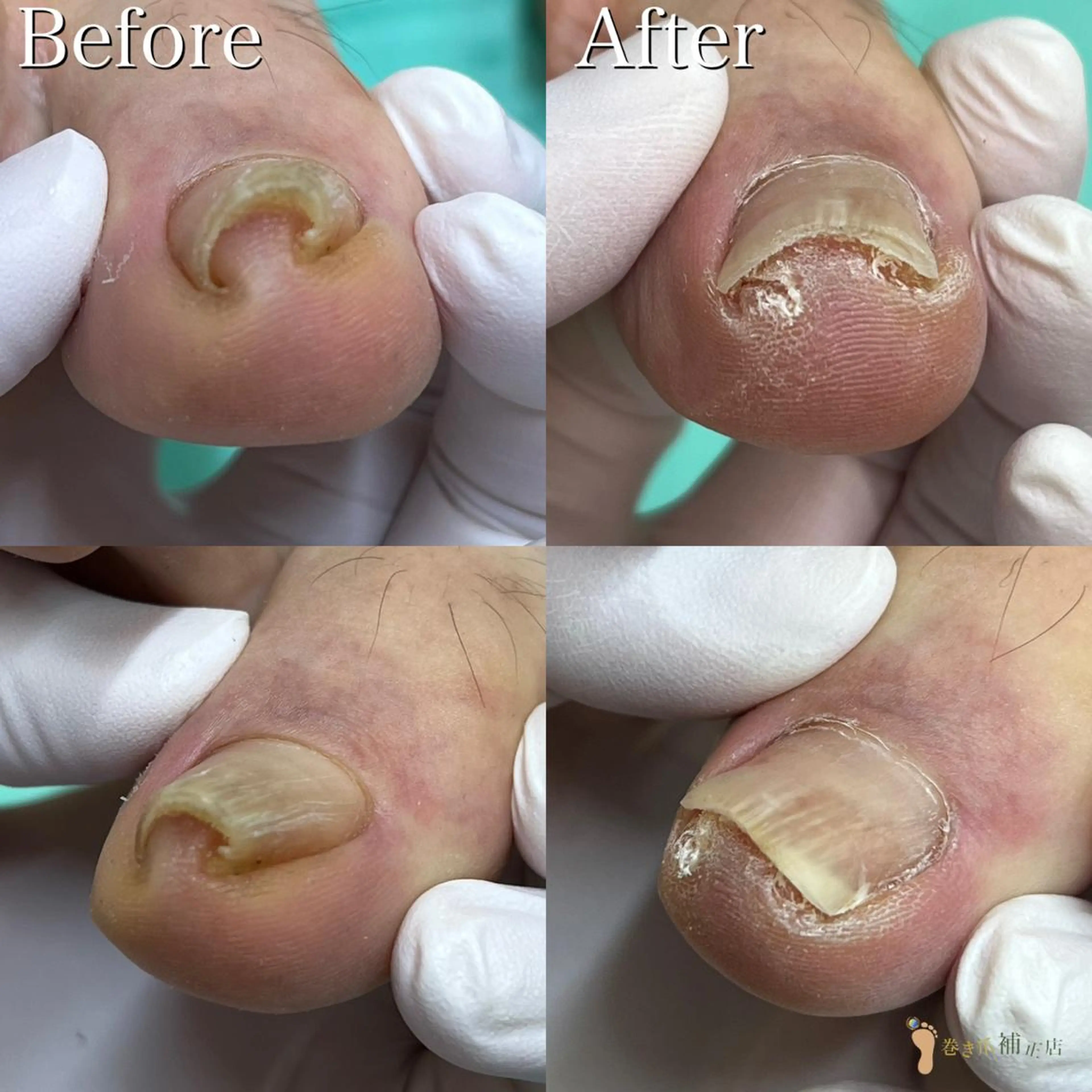 東京巻き爪アカデミー所属・東京巻き爪 アカデミーのエステ・リラクイメージ