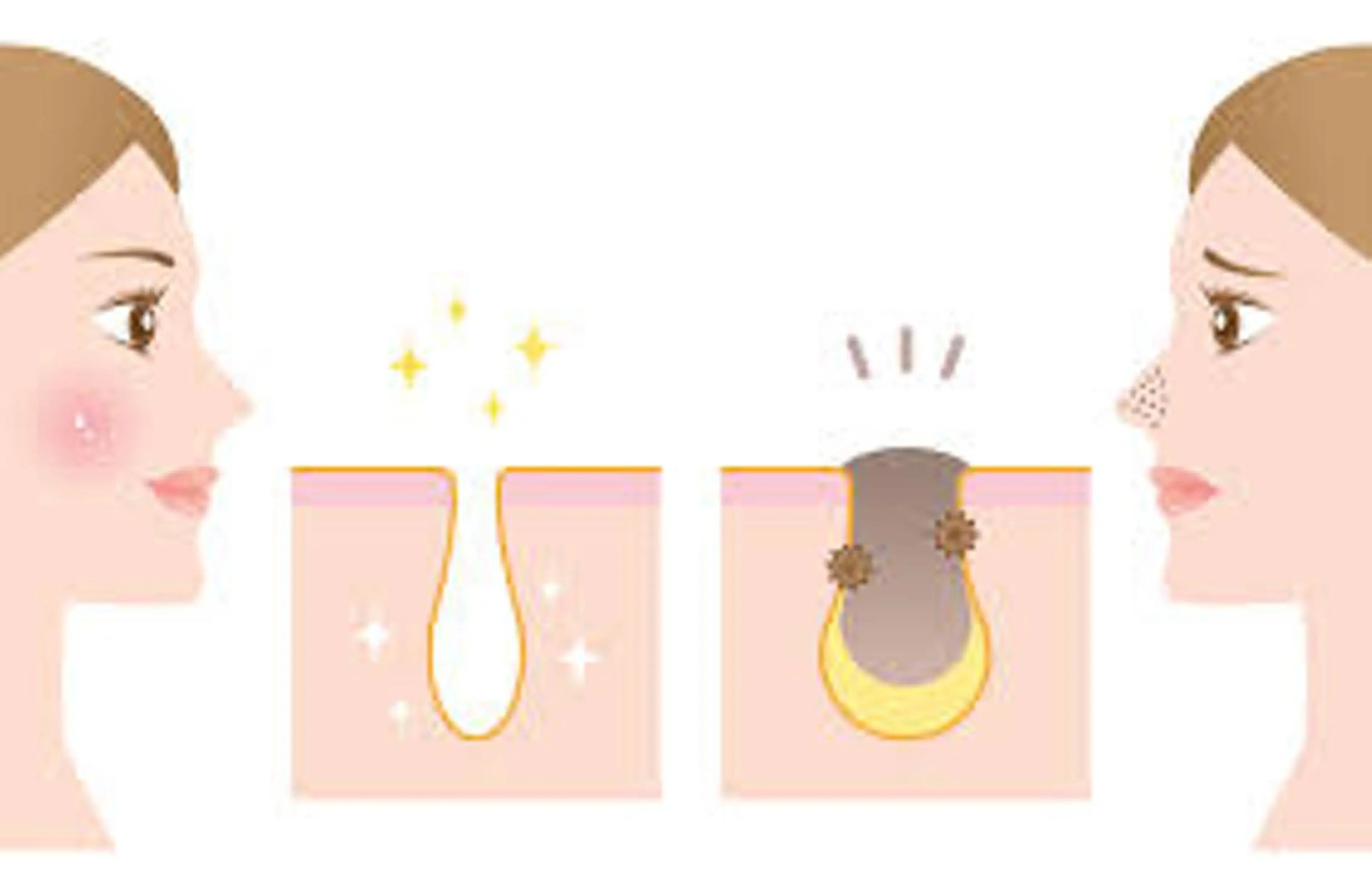 脱毛 都度払い脱毛⭐️ 脱毛サロンMIRACのエステ・リラクイメージ