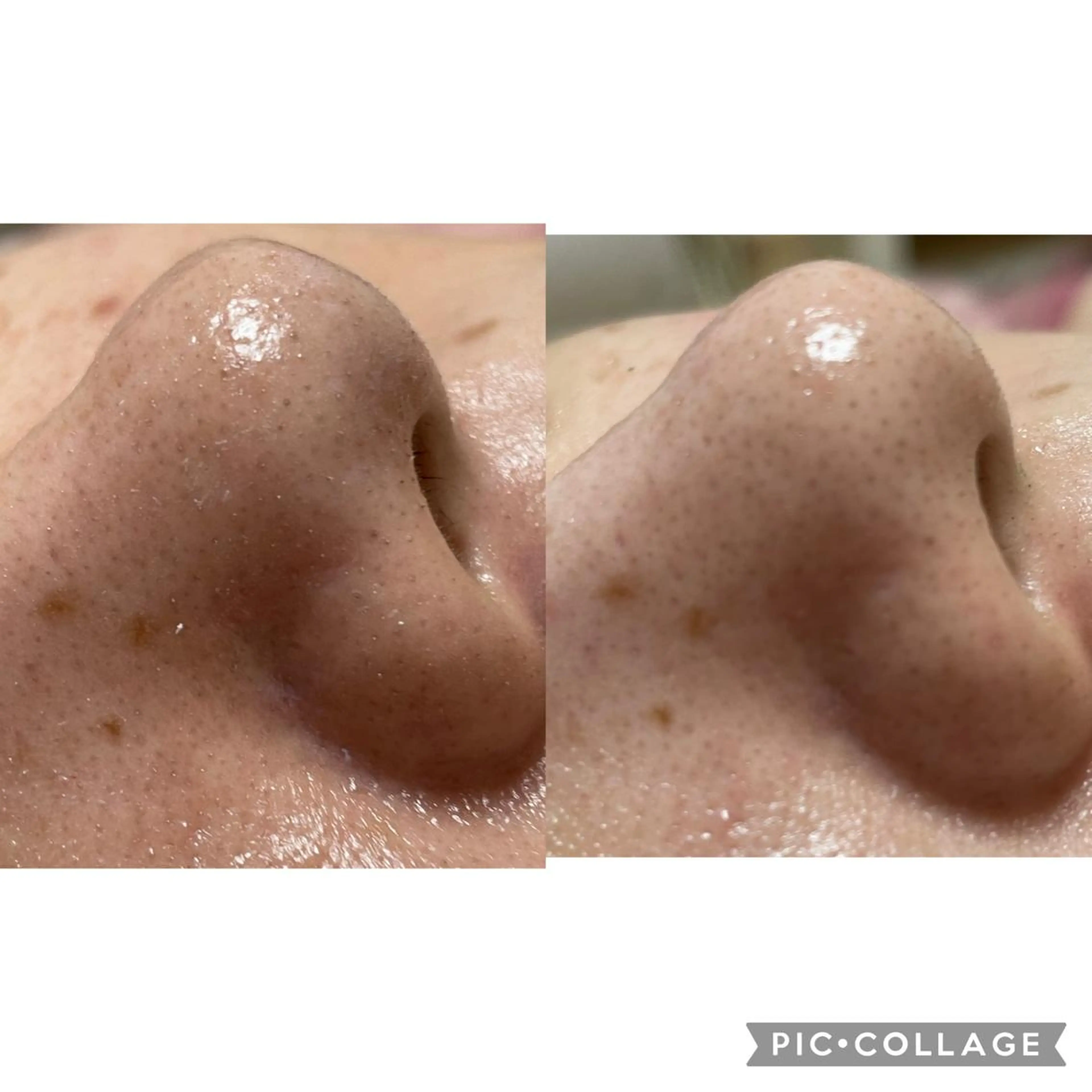 エステ 伊藤 順子のその他イメージ