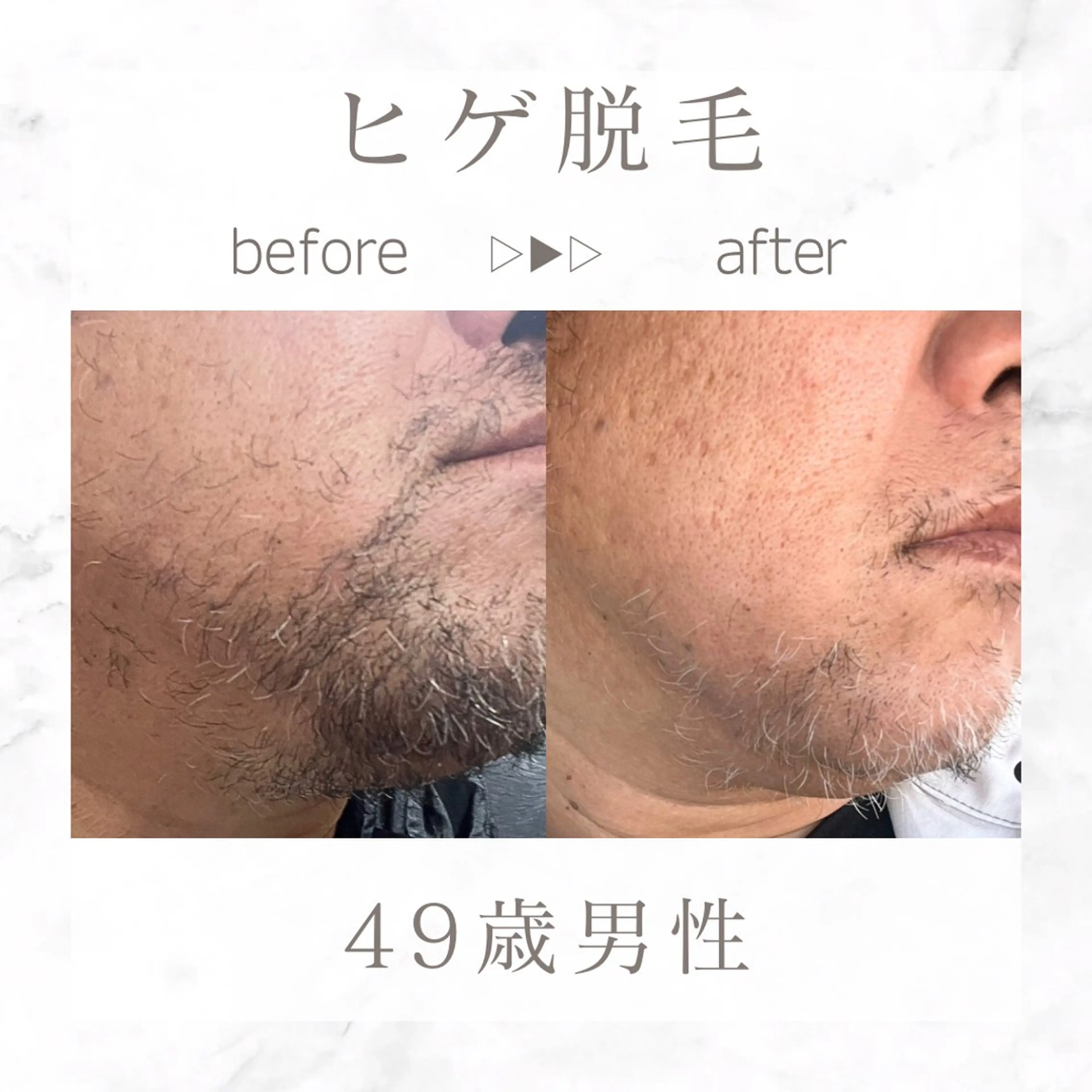 メンズ 脱毛 エステサロンNarcis〜ナルシス〜所属・脱毛＆痩身エステ Narcisのエステ・リラクイメージ