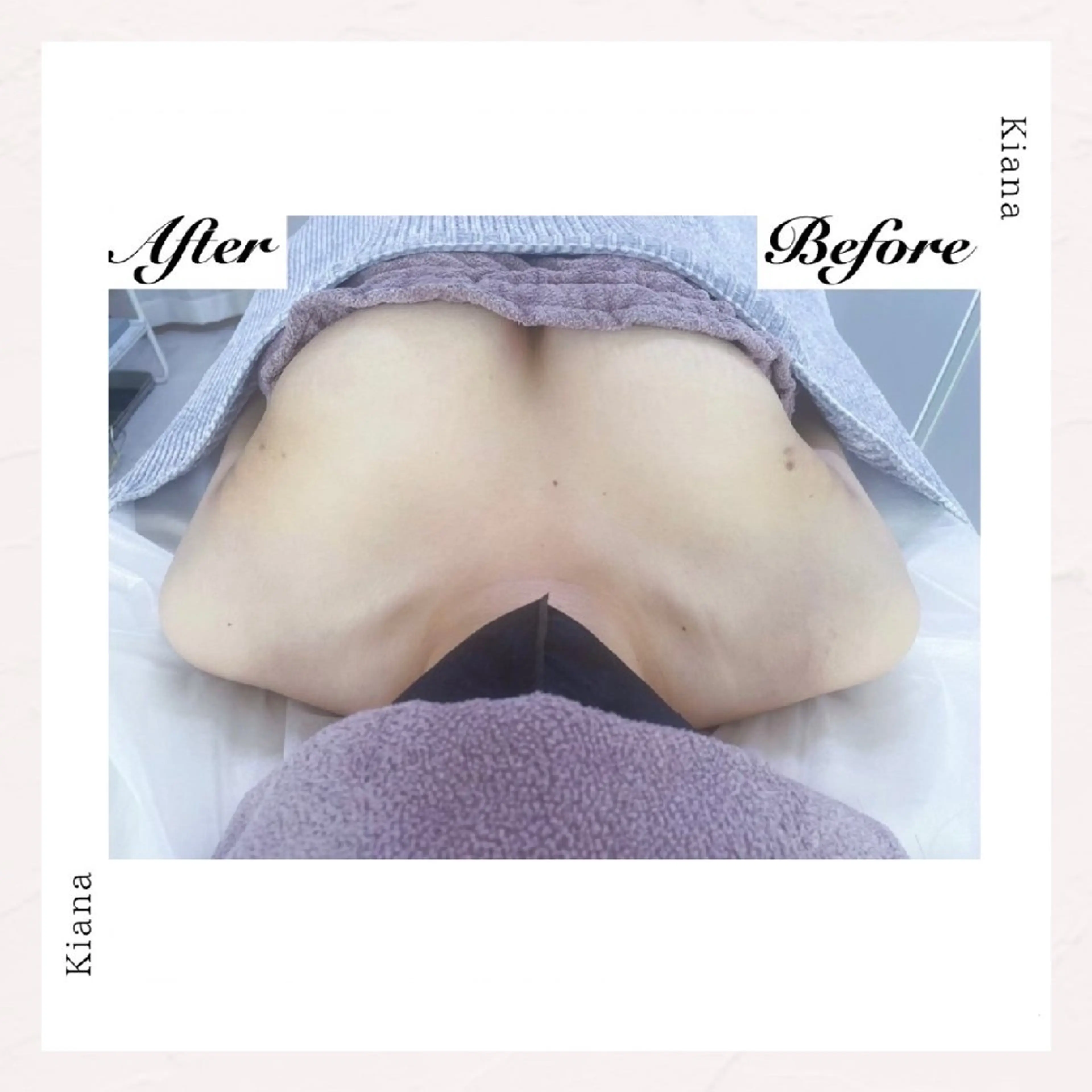 【バスト専門店 】 Kiana のエステ・リラクイメージ