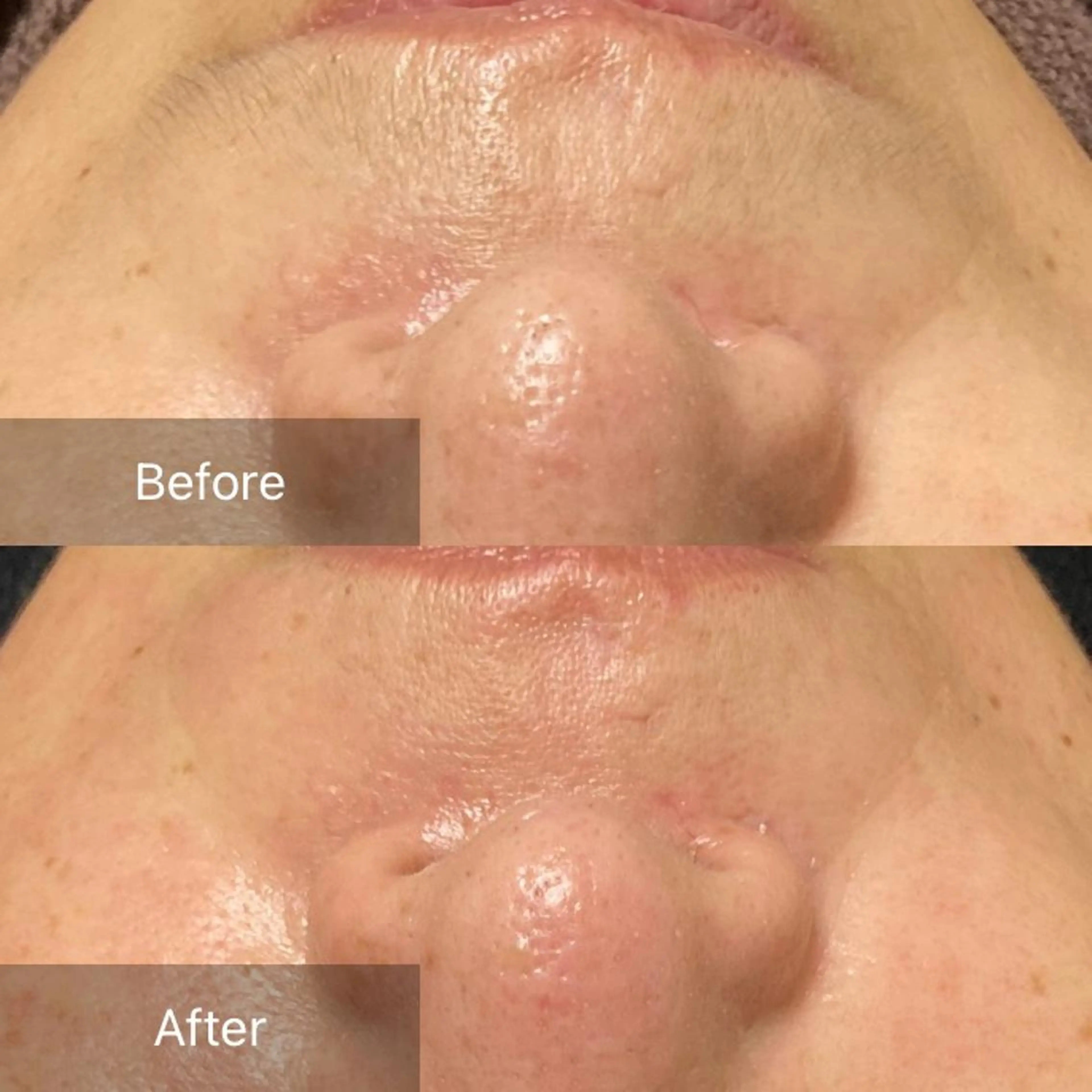 脱毛 産毛専門店 Bittoのエステ・リラクイメージ