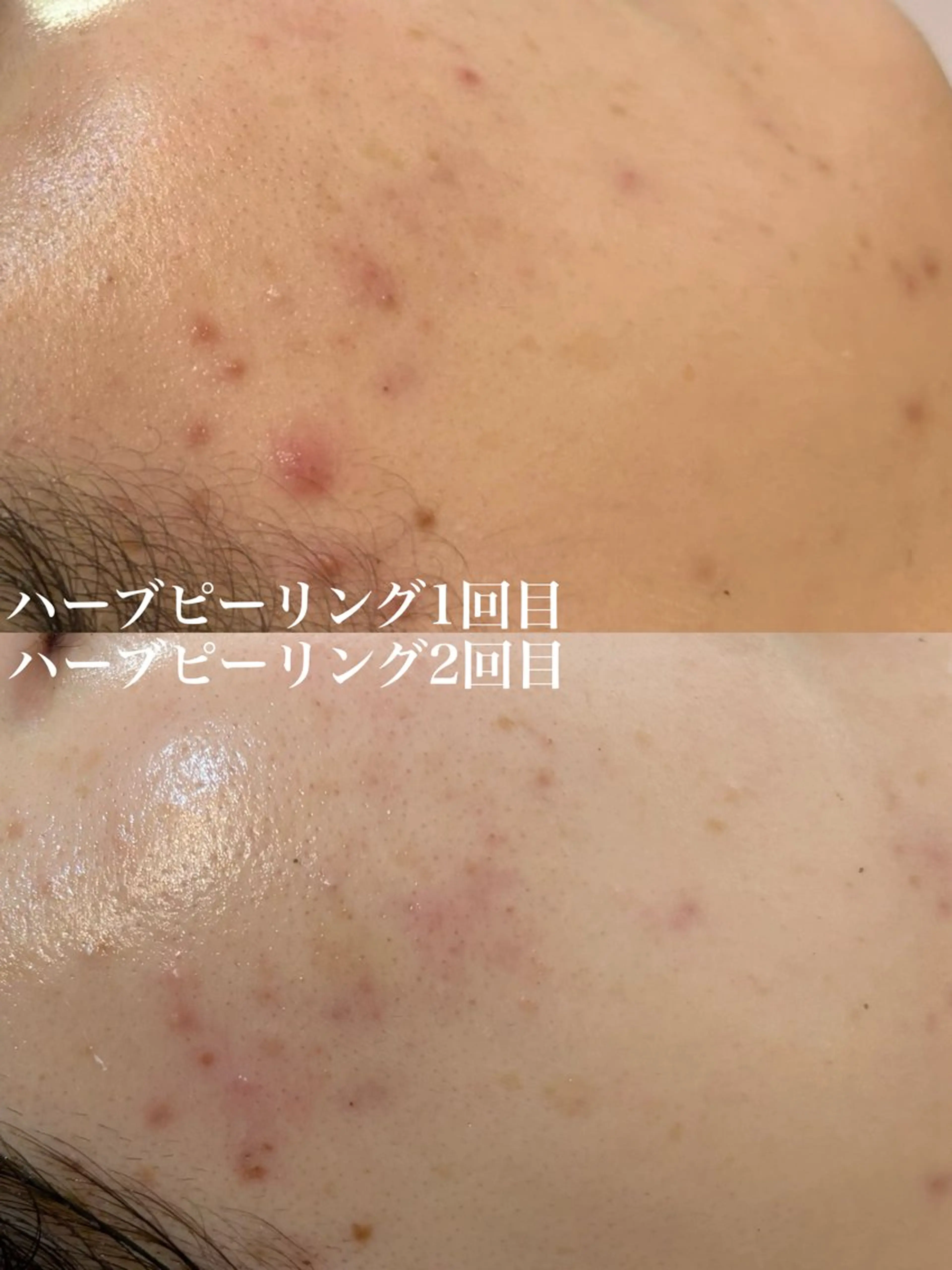 エステ WHITE AQUA 北千住店のエステ・リラクイメージ