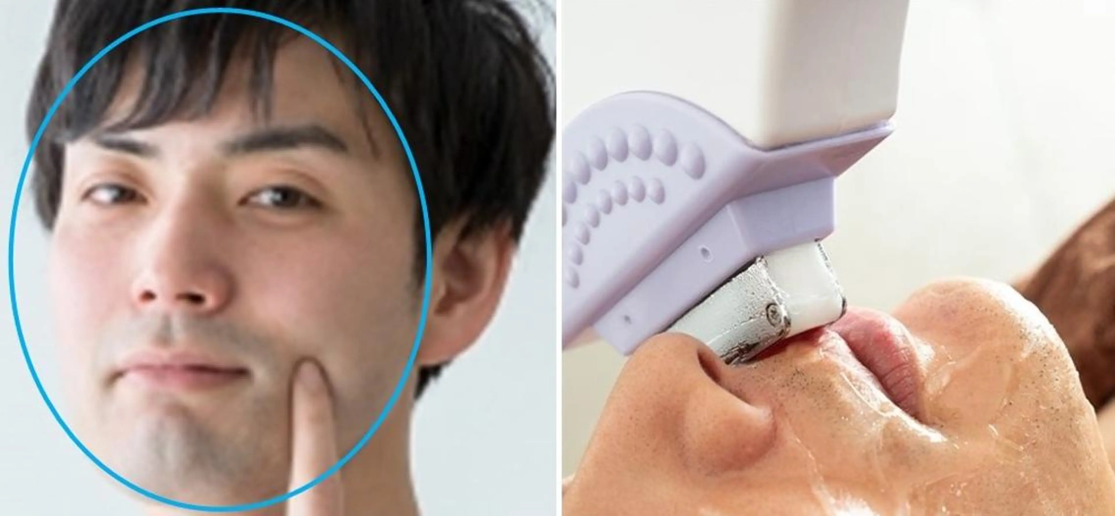 [メンズ脱毛]　　全顔(眉下以外全て)¥7998⇒半額¥3999の写真