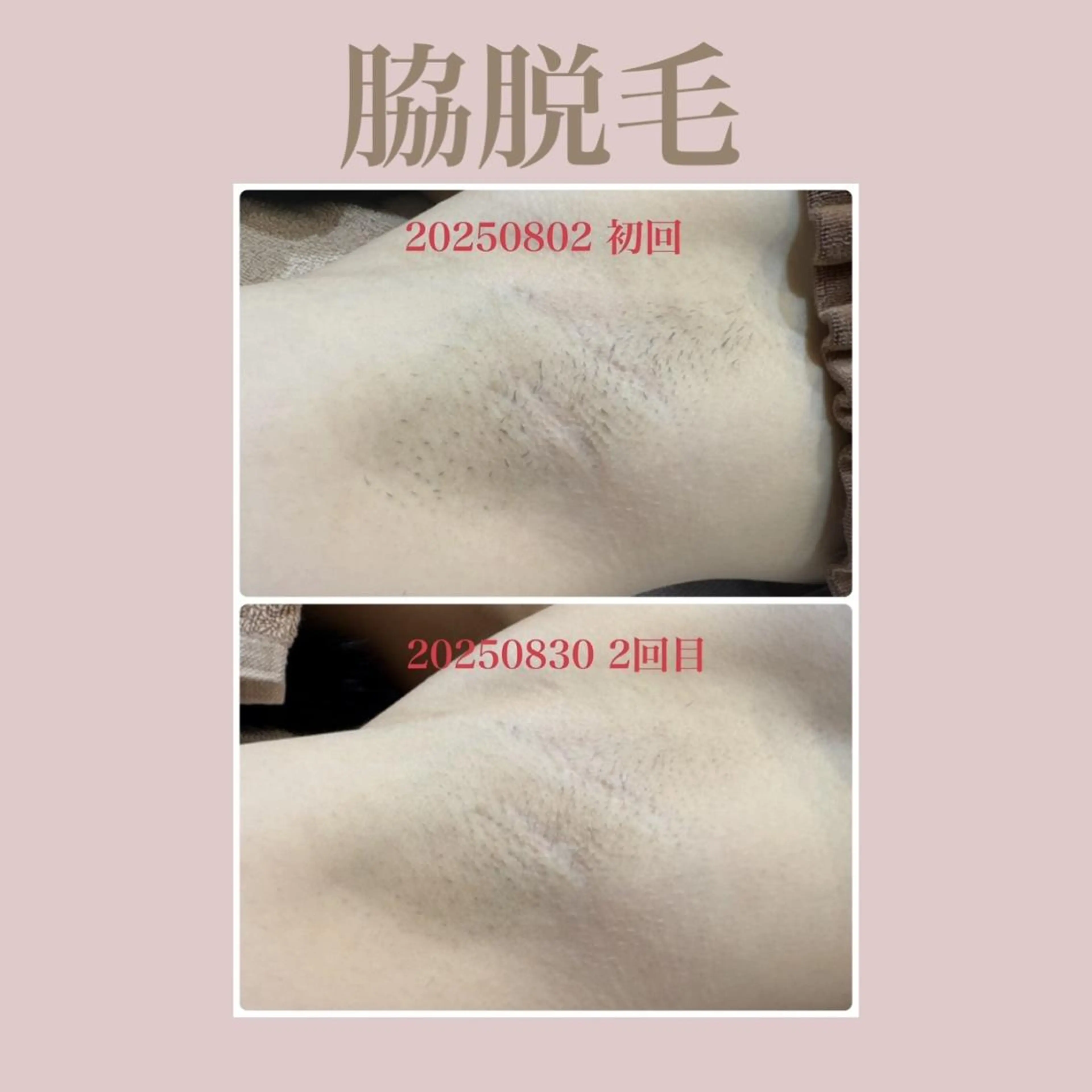 👑Linolaby RAYVIS👑⭐️のエステ・リラクイメージ