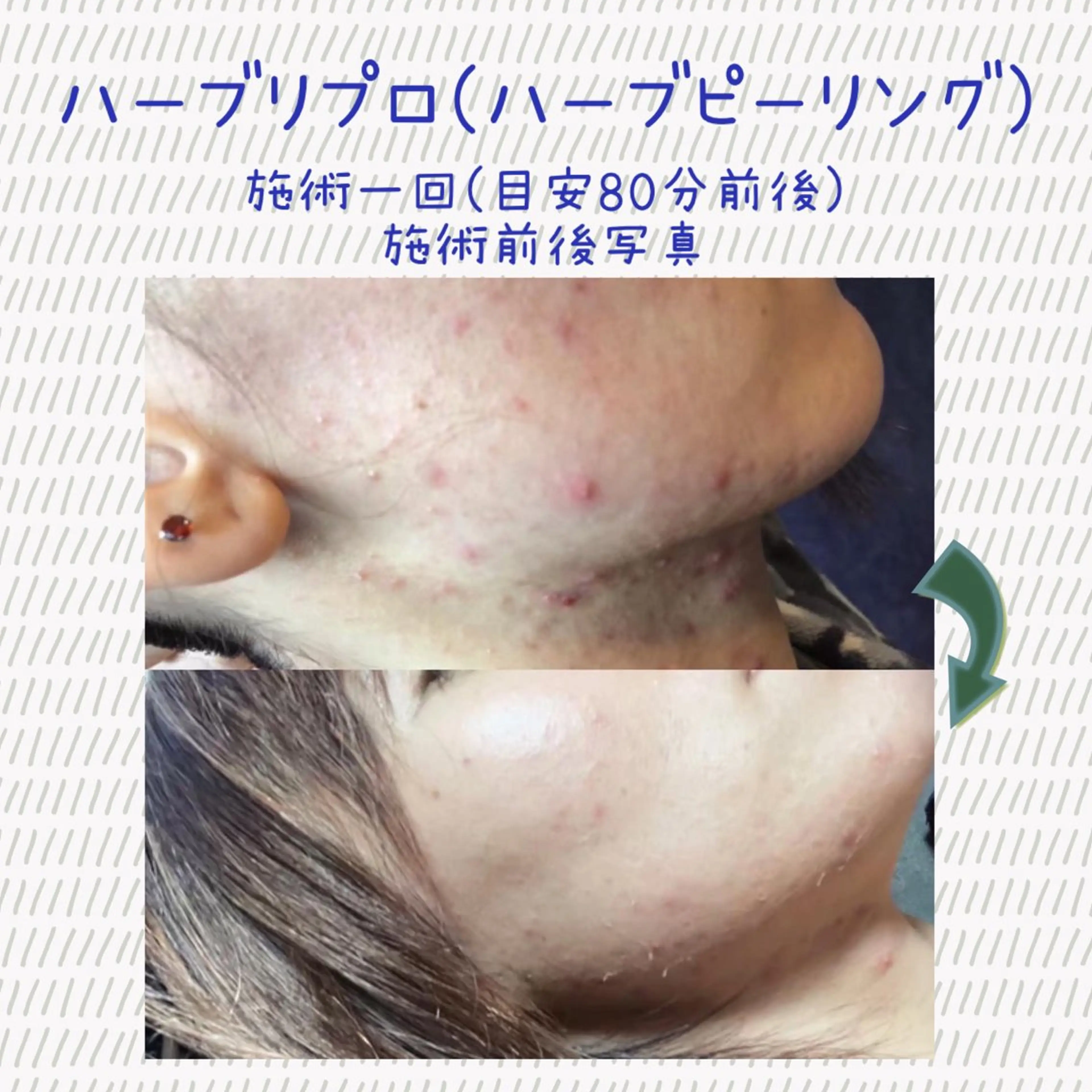 Laplace池袋本店(ラプラス池袋本店)所属・Laplace 池袋本店のその他イメージ