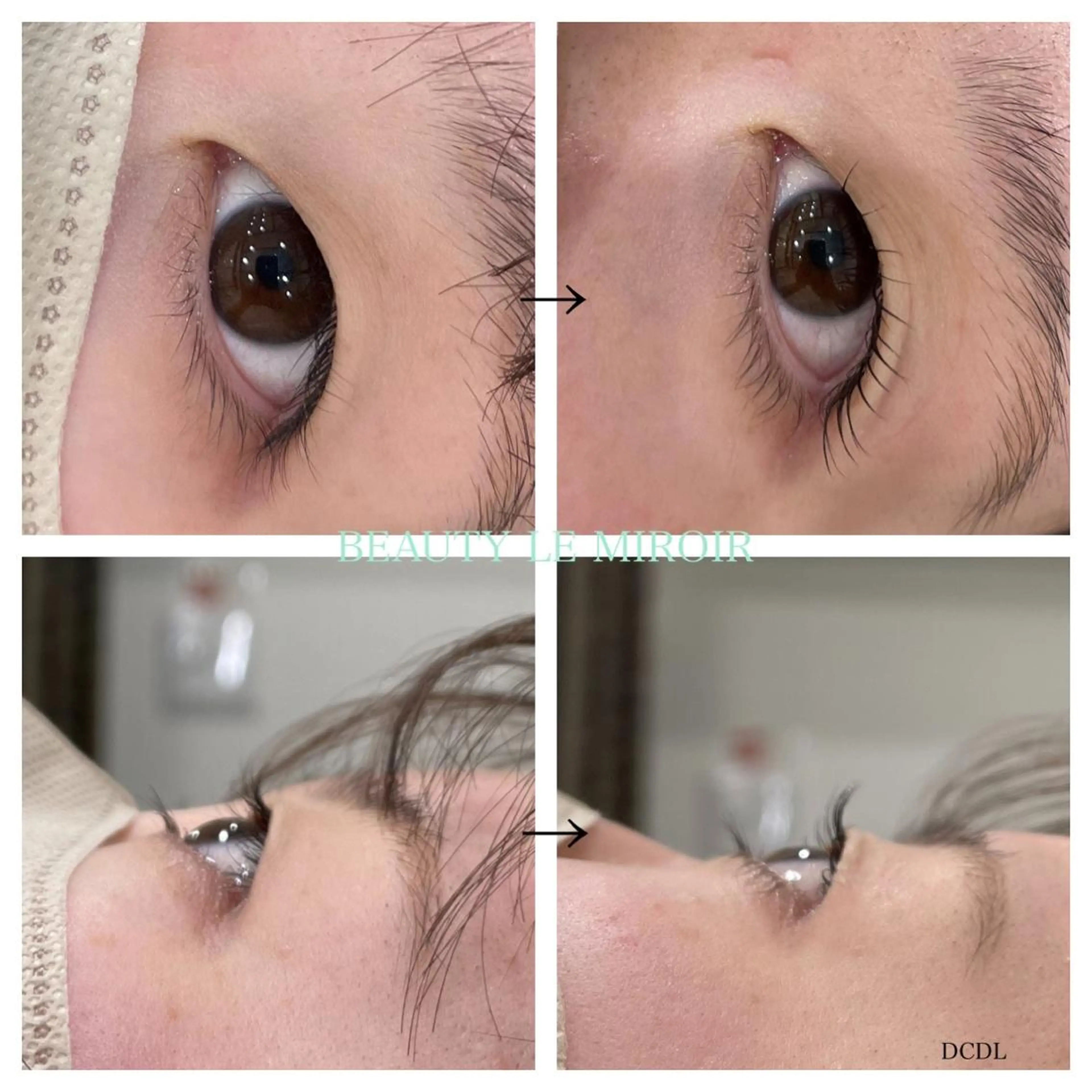 マツエク・マツパ ビューティー ミロワールのエステ・リラクイメージ