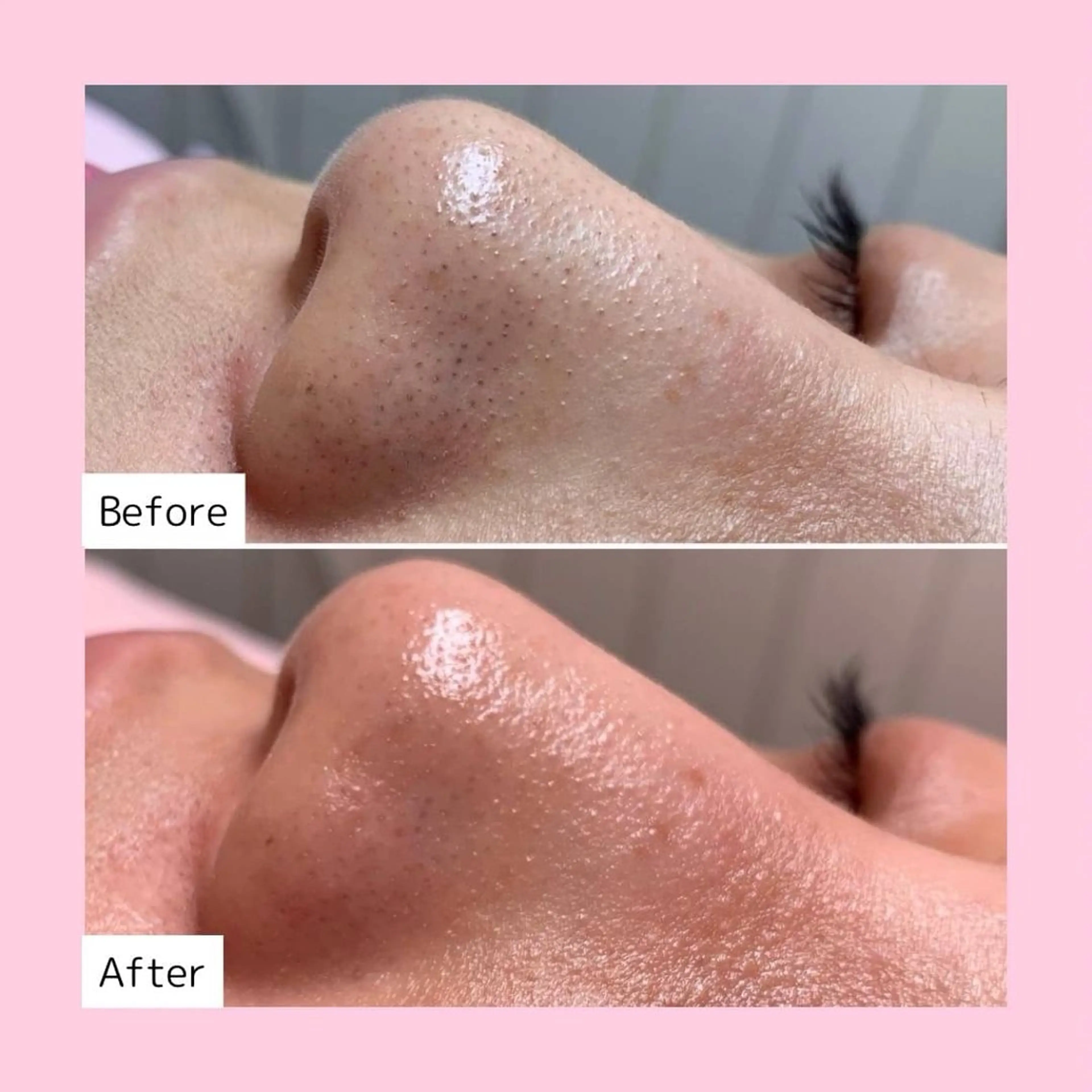 エステ 韓国肌管理専門店　White labo 宝塚店所属・有川 凜のエステ・リラクイメージ