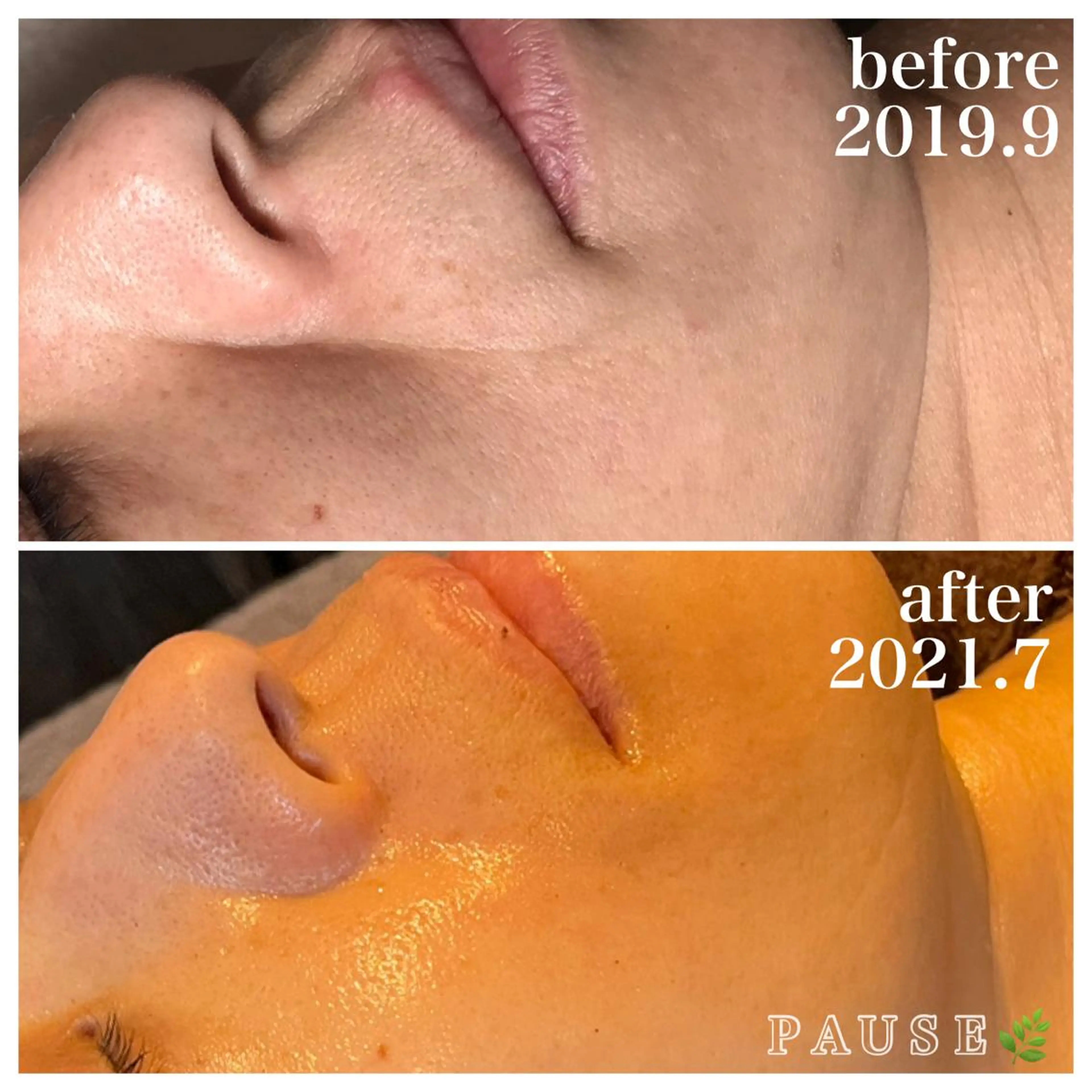 エステ 浜野 恵美のエステ・リラクイメージ