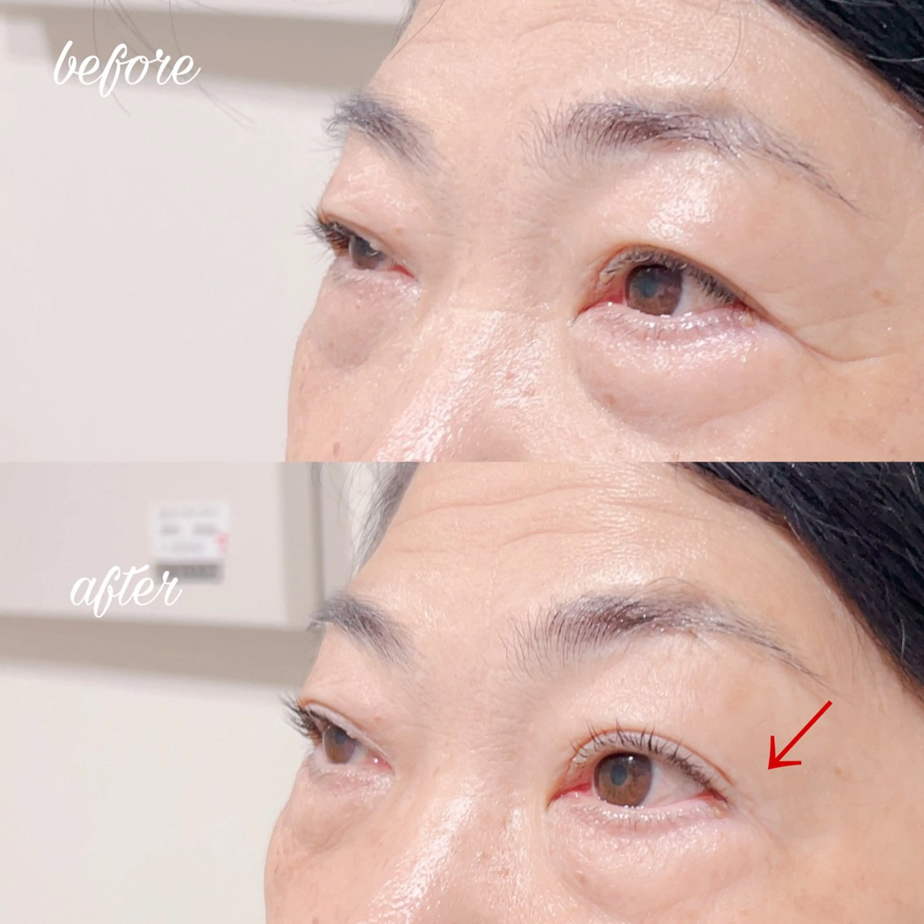 マツエク・マツパ アイリッドアップパーマ マツパ merveilles所属・まつげ/整体/にきび ・アトピー専門サロンのマツエク・マツパデザイン