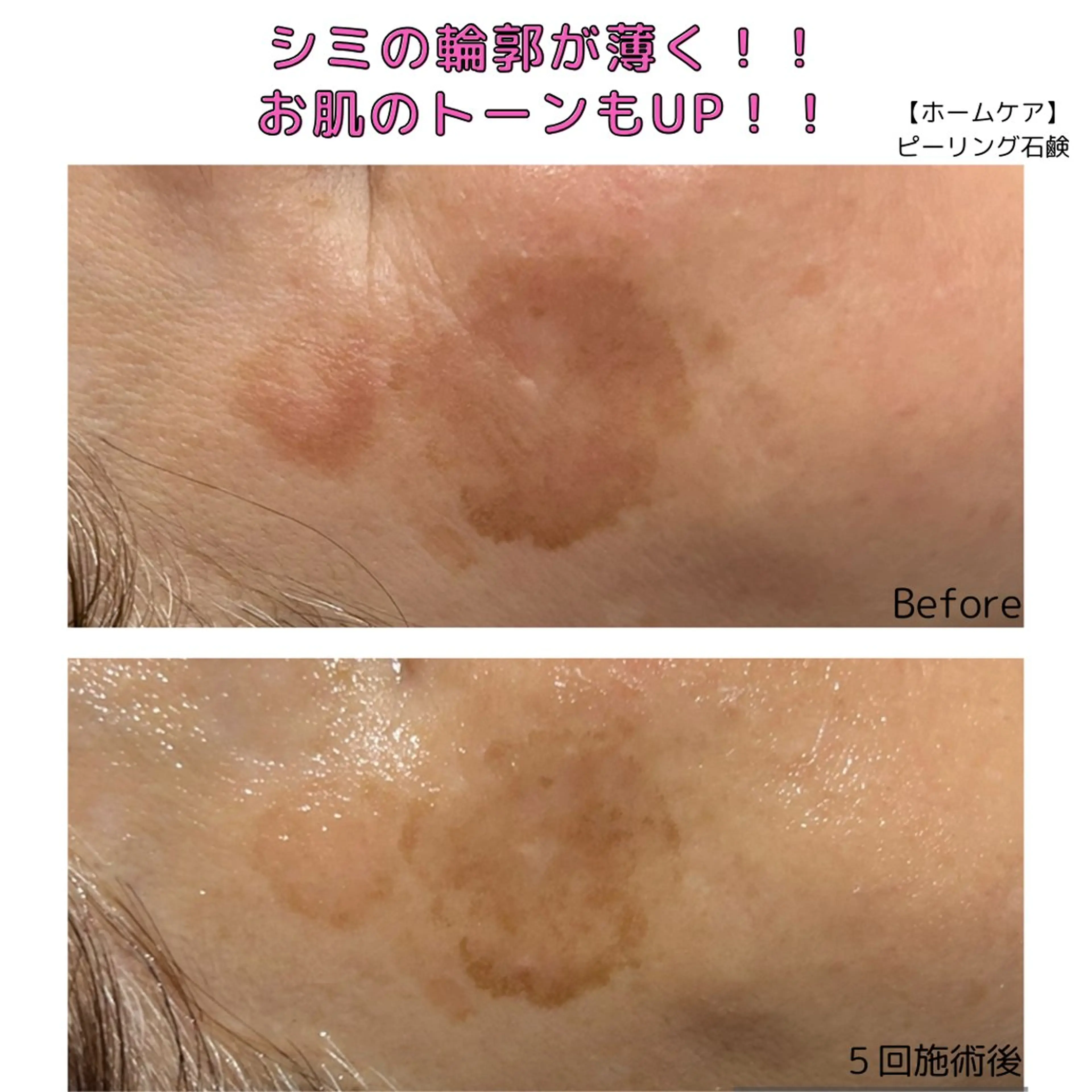 leolo武蔵浦和 肌質改善&脱毛のエステ・リラクイメージ