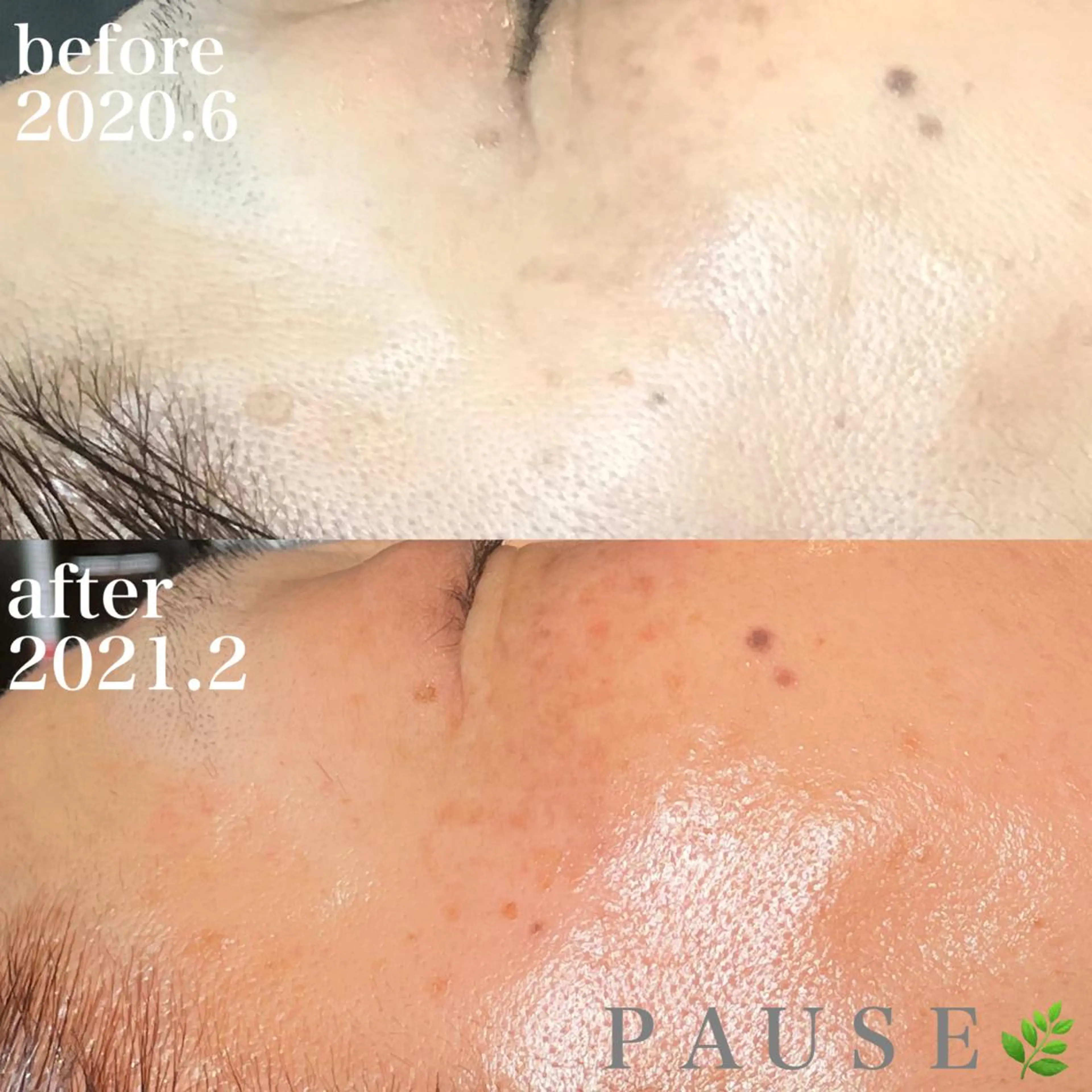 エステ 浜野 恵美のエステ・リラクイメージ