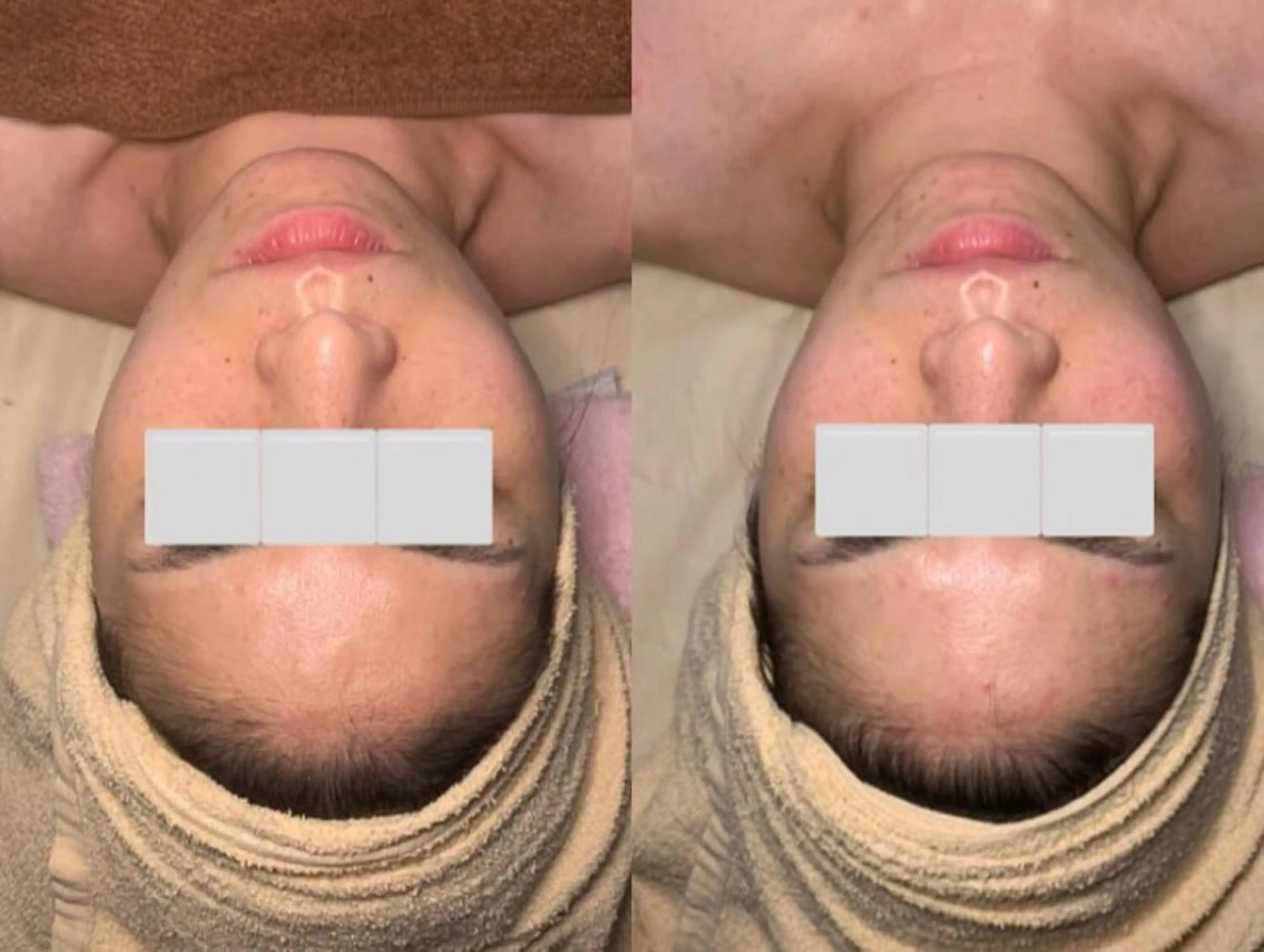 a  room salonのエステ・リラクイメージ