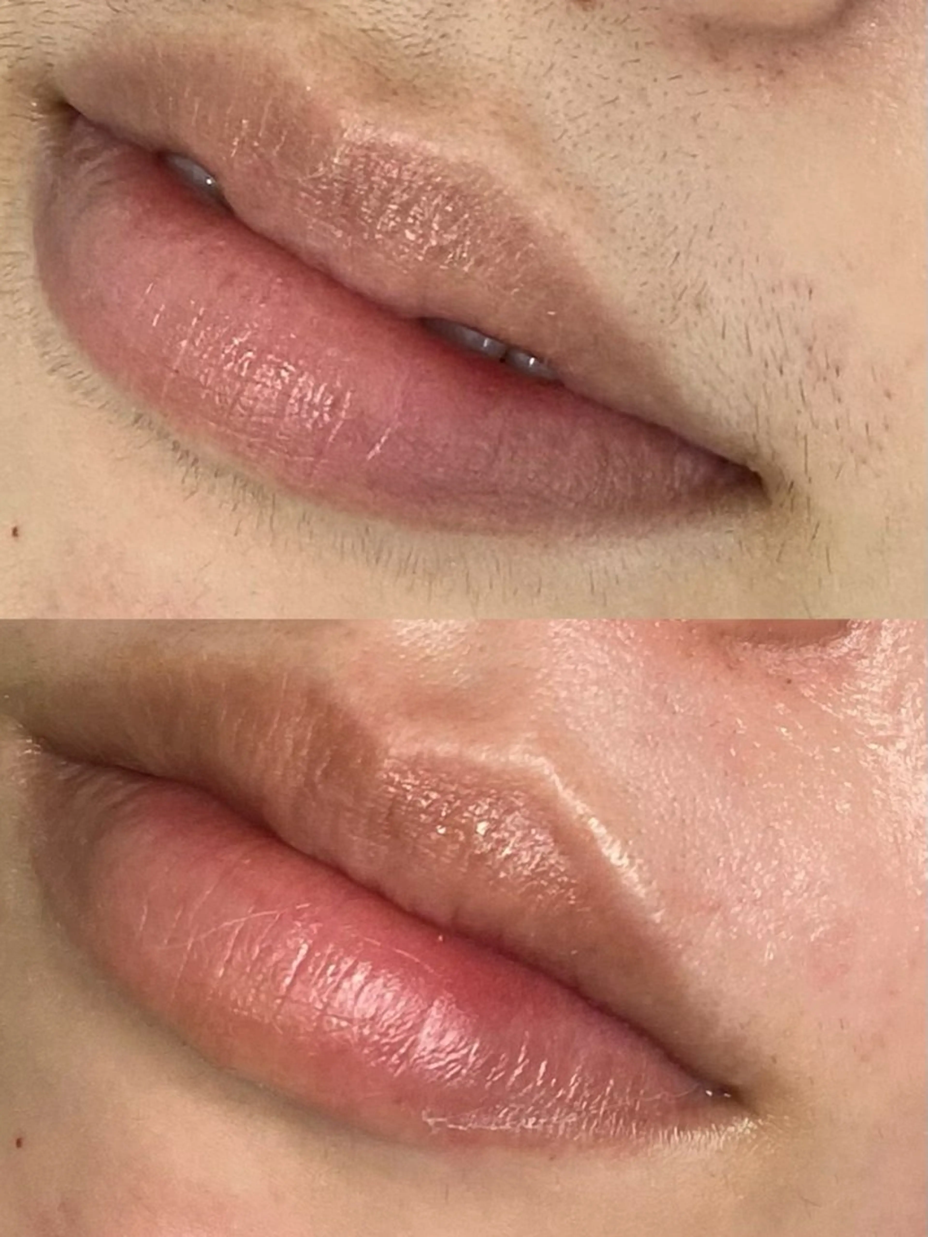 脱毛 schön所属・schön 松井のエステ・リラクイメージ