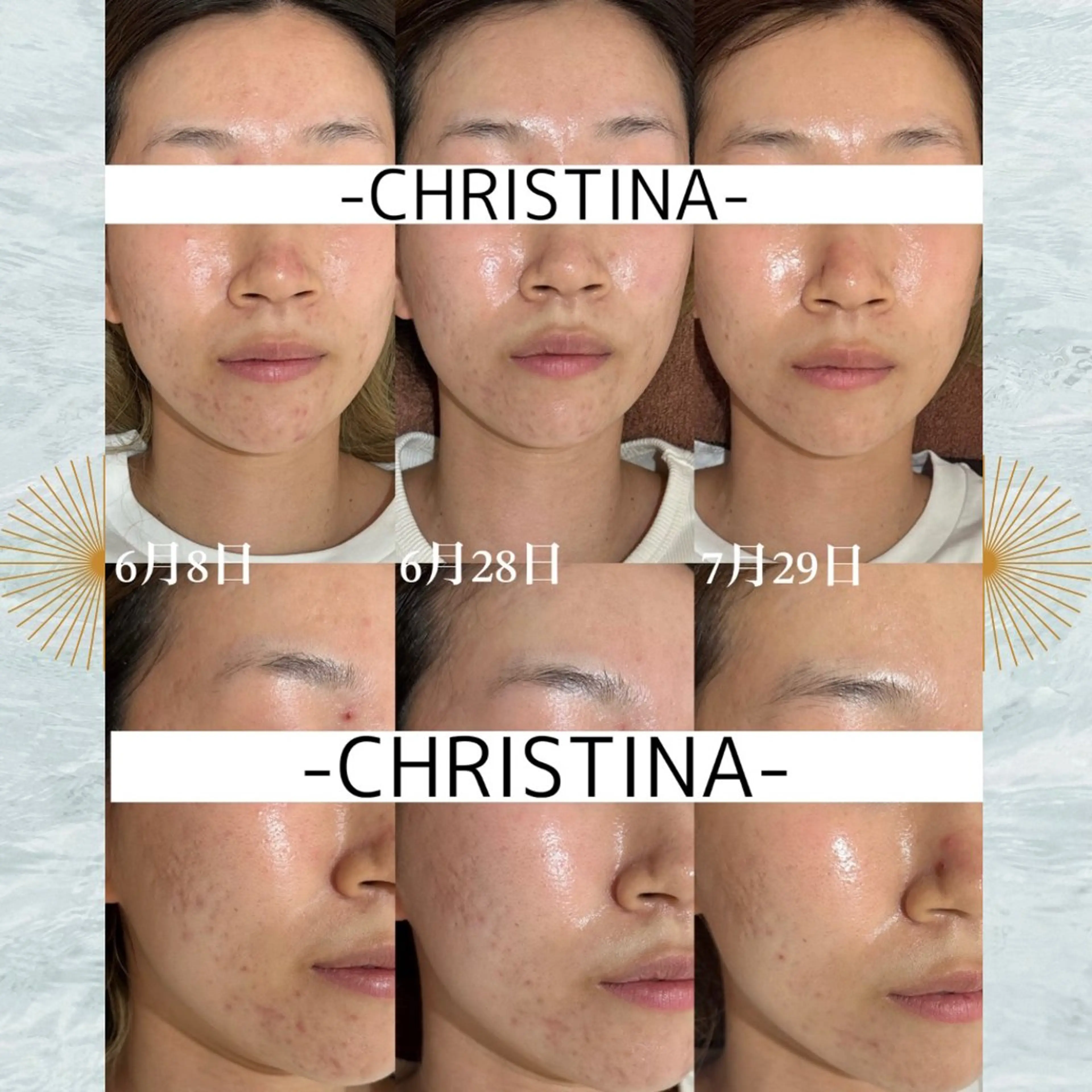 mieux所属・ハーブピーリング ¥6600のエステ・リラクイメージ