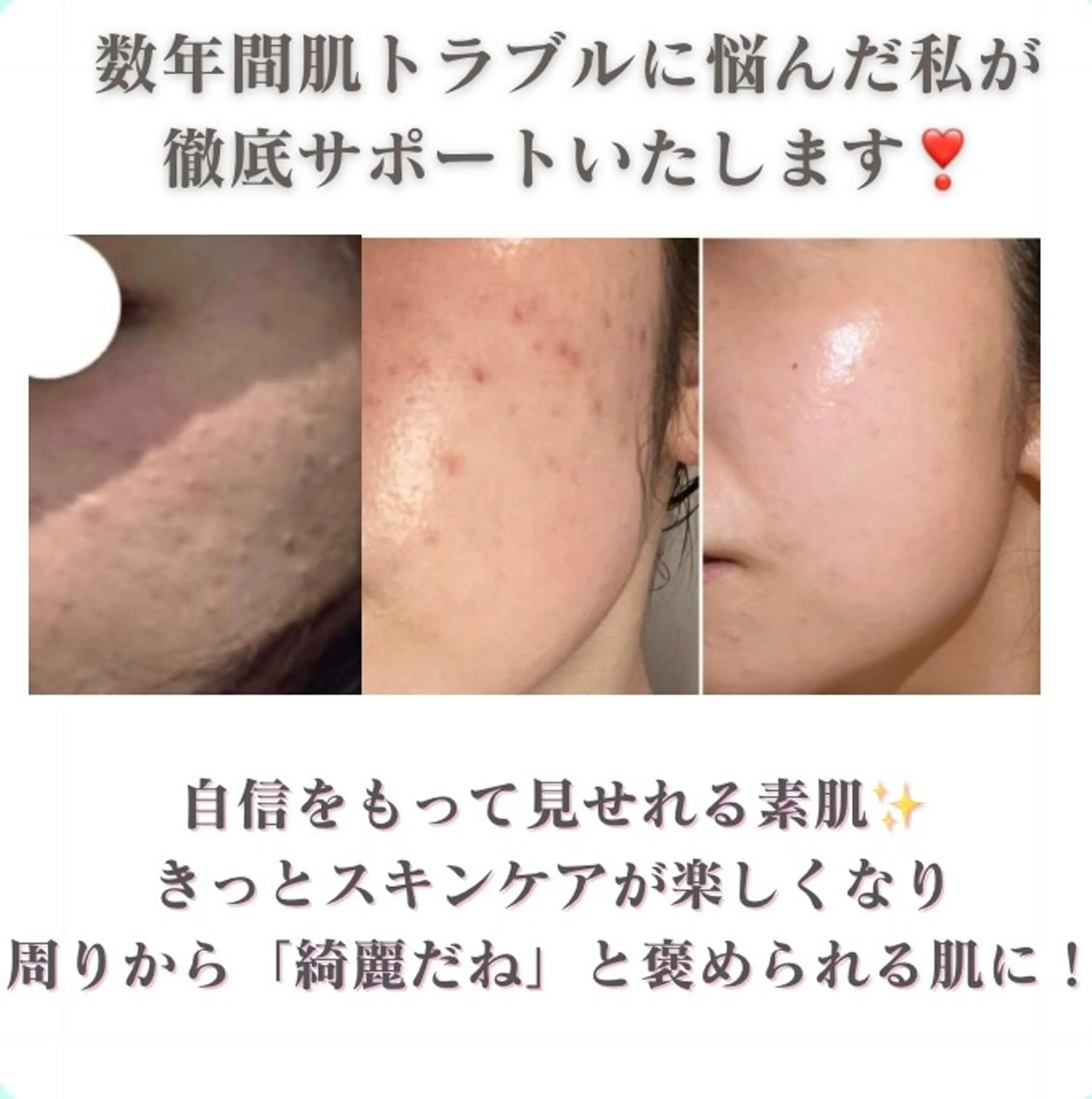 aisea（アイシー）所属・アイシー 〜大人の毛穴ツヤ肌〜のエステ・リラクイメージ