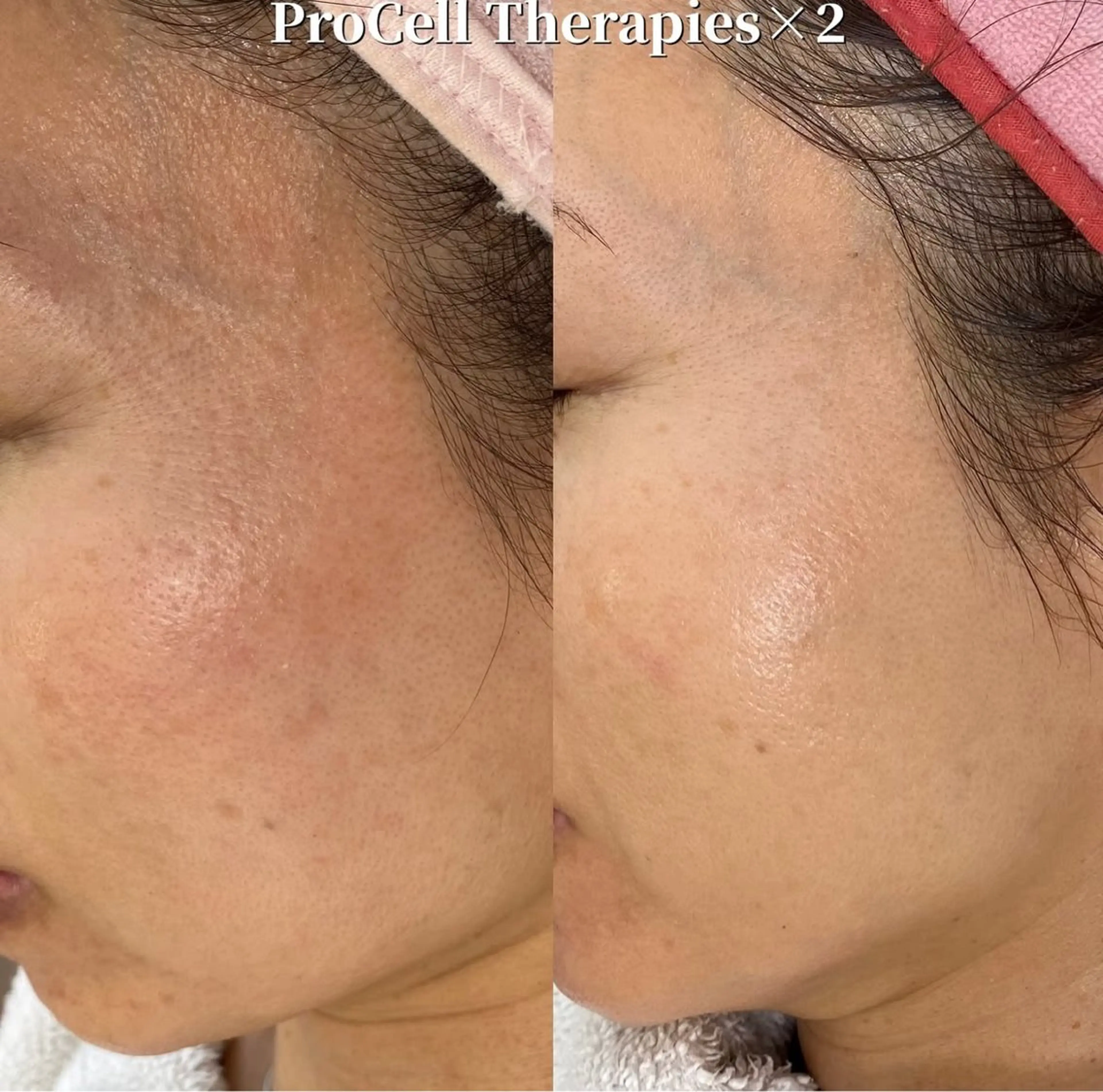 Blooming所属・LOUISE. ／肌質・頭皮のエステ・リラクイメージ