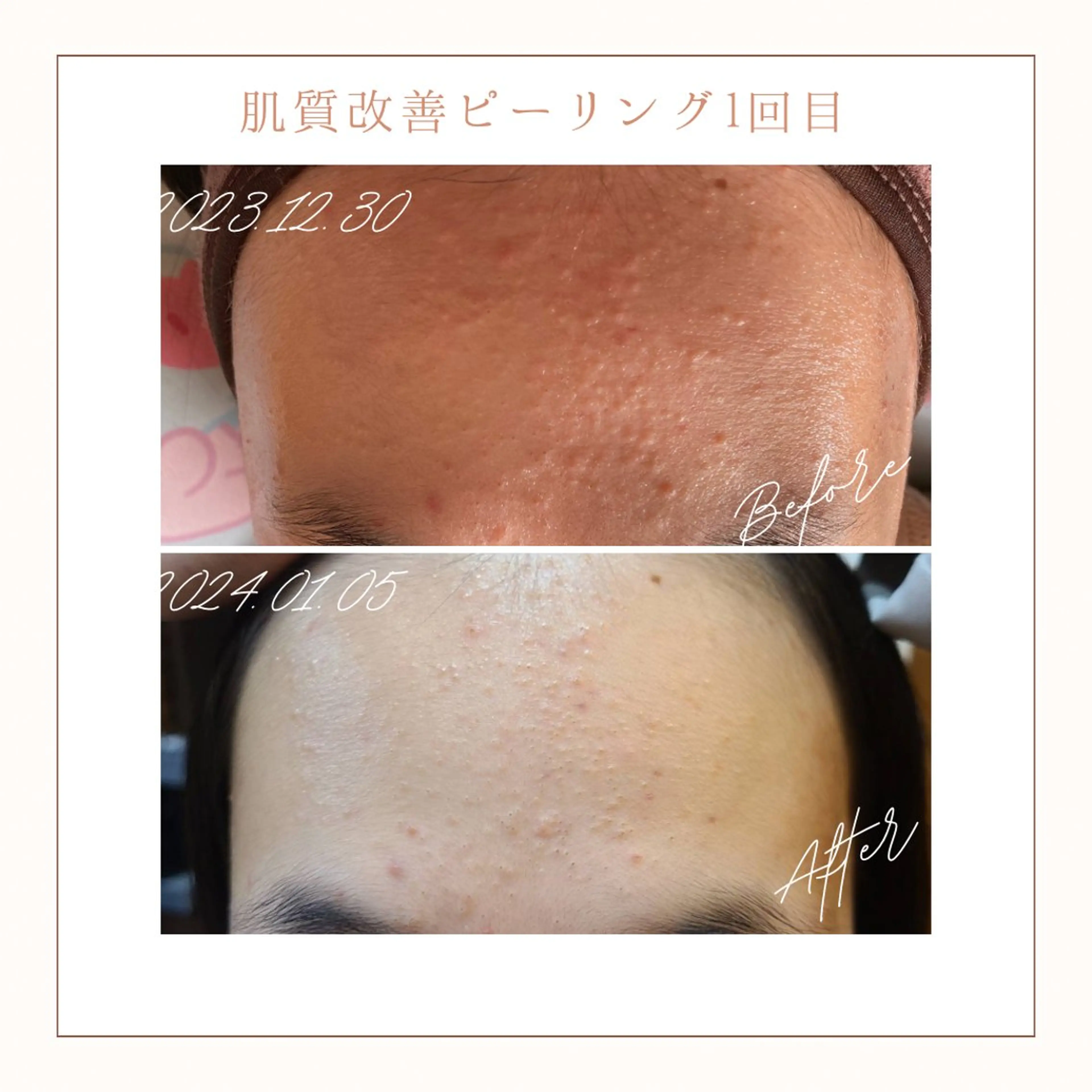 エステ リラク 小顔×肌質改善サロン soin〔ソワン〕のエステ・リラクイメージ