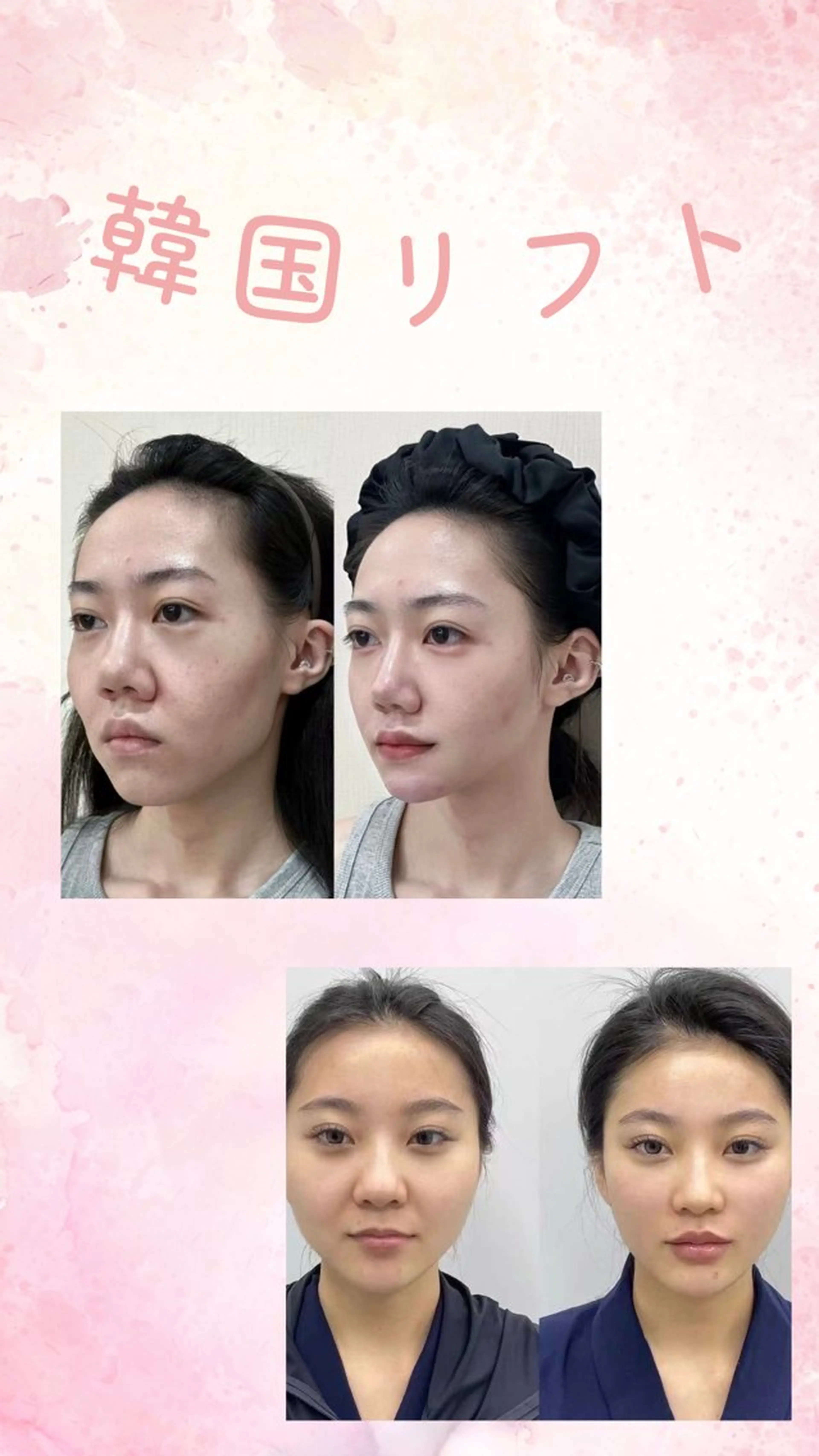 パーマ エステ 愛維美水光美肌専門店所属・愛維美水光美肌専門店 メンズレディースokのエステ・リラクイメージ