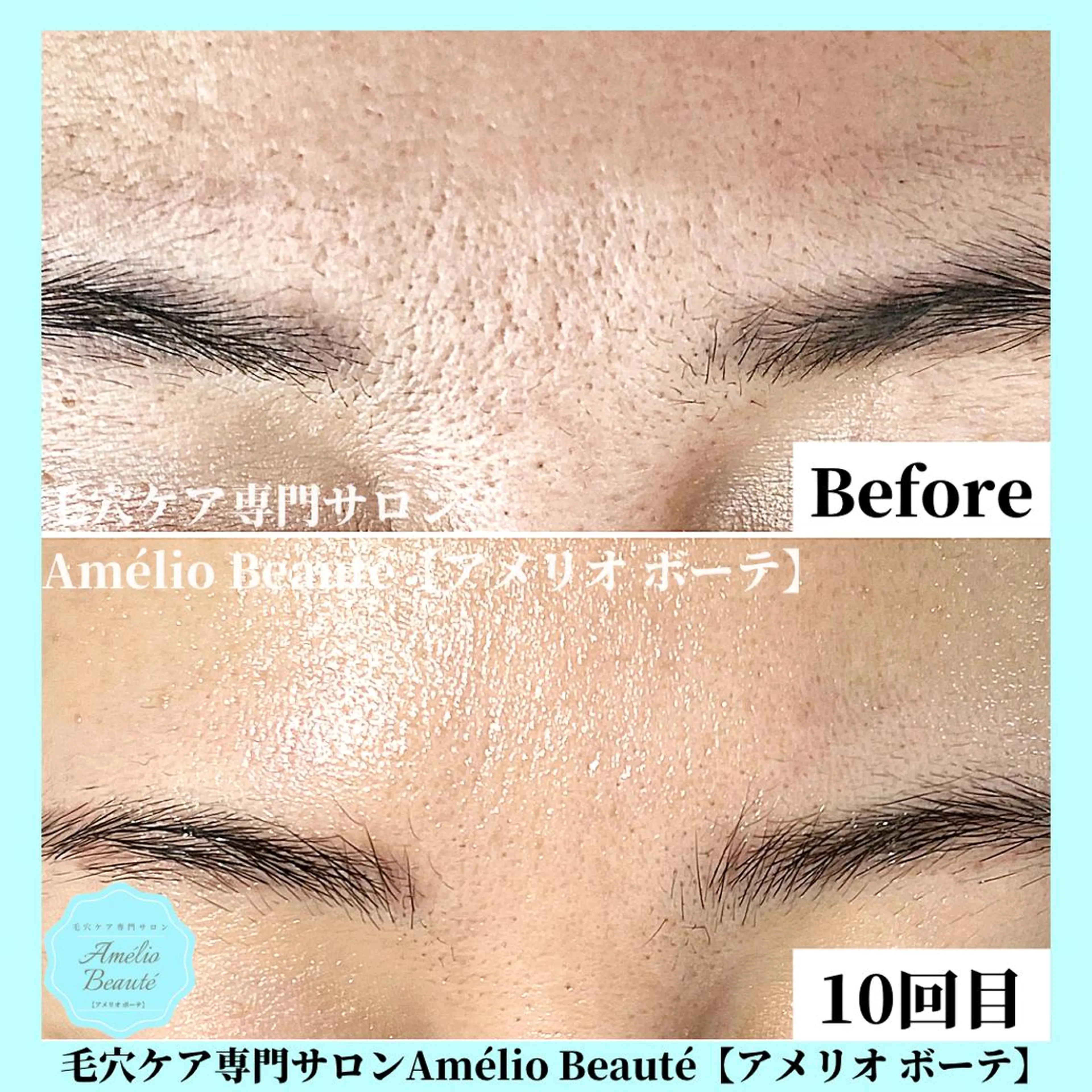 毛穴ケア専門サロン Amélio Beauté所属・毛穴ケア専門サロン アメリオボーテのその他イメージ