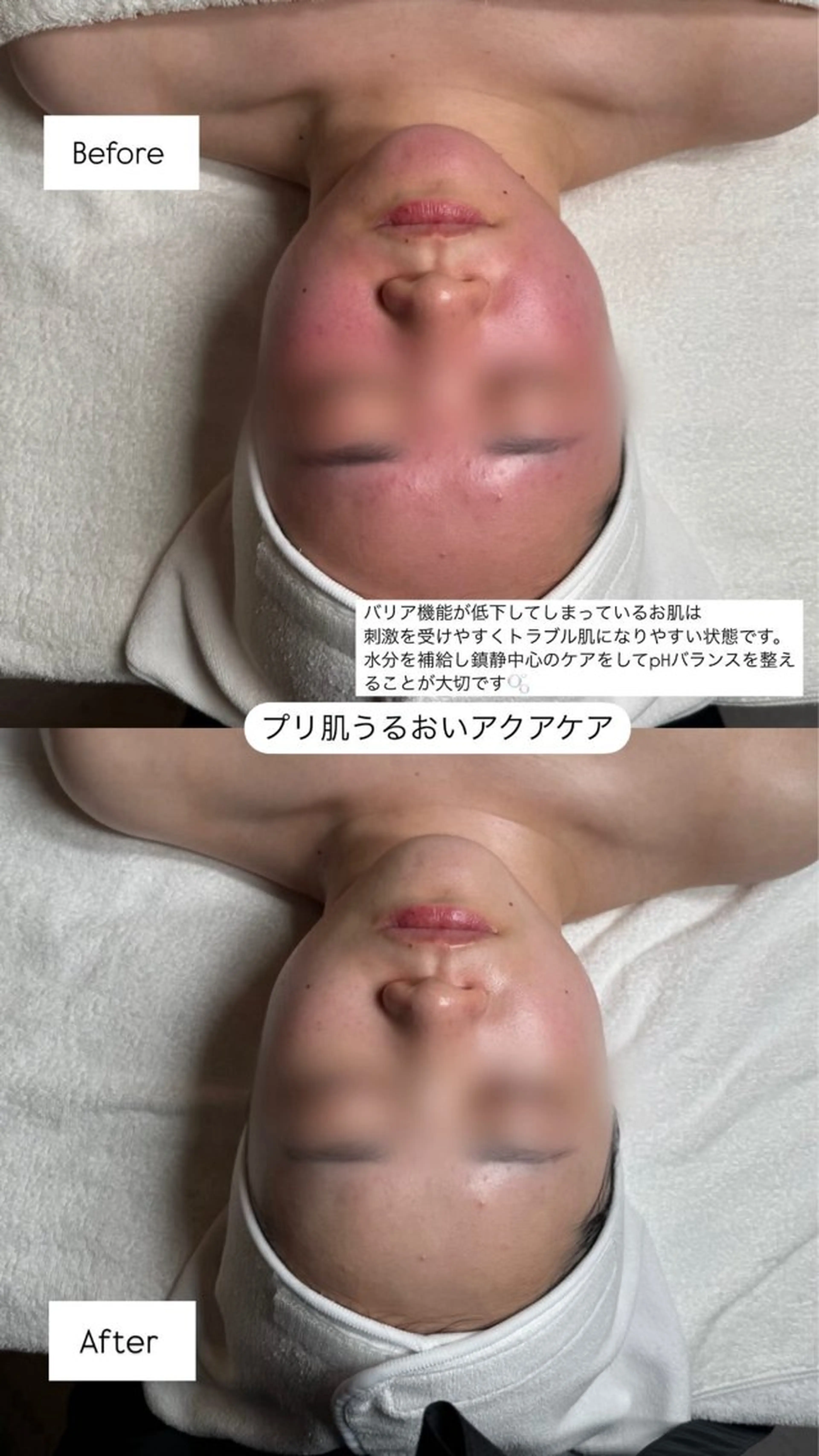 韓国肌管理🫧LDM 🫧Junnaのエステ・リラクイメージ