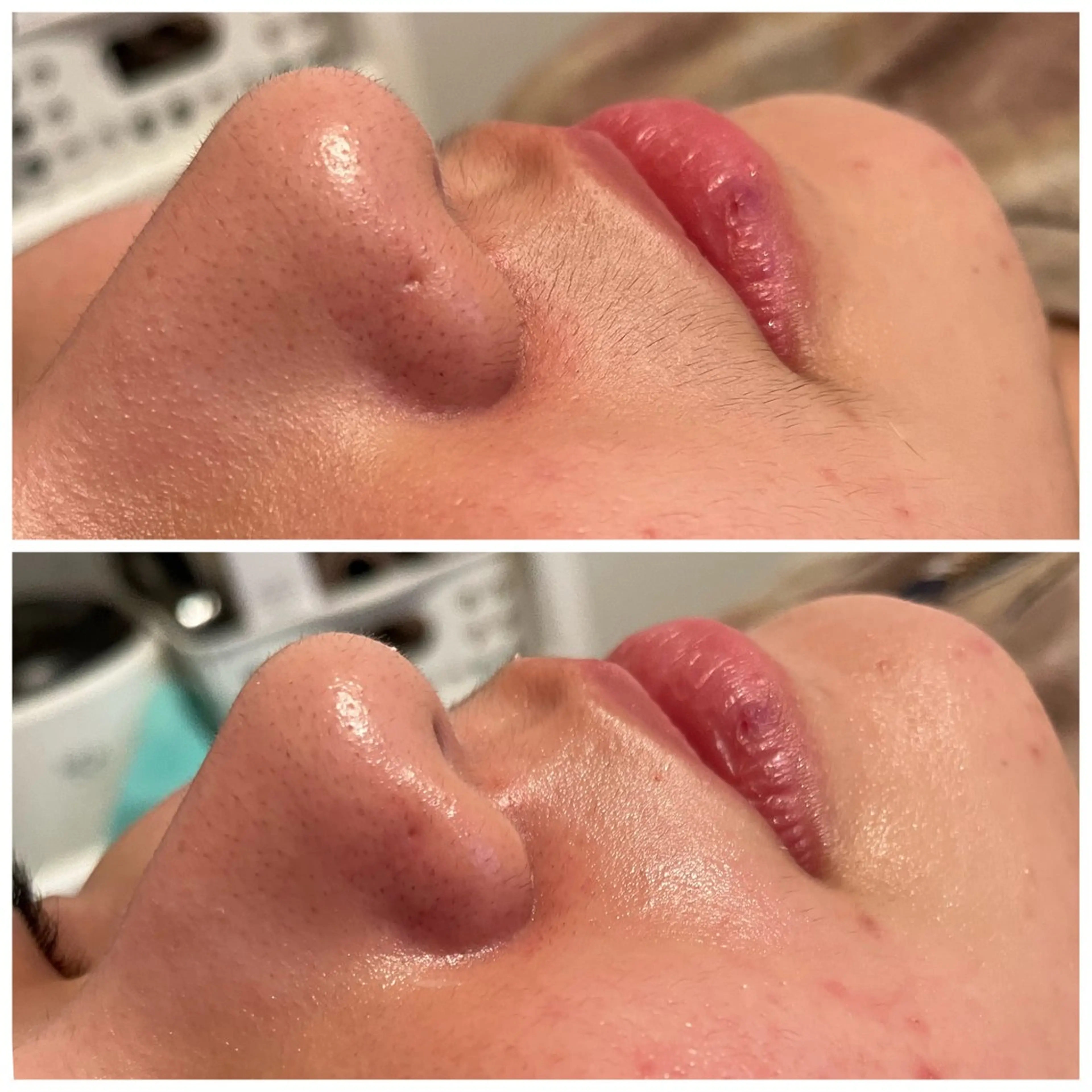 Ｂ&H所属・頭痛•肩こり専門/ 眉サロンB&H心斎橋のエステ・リラクイメージ