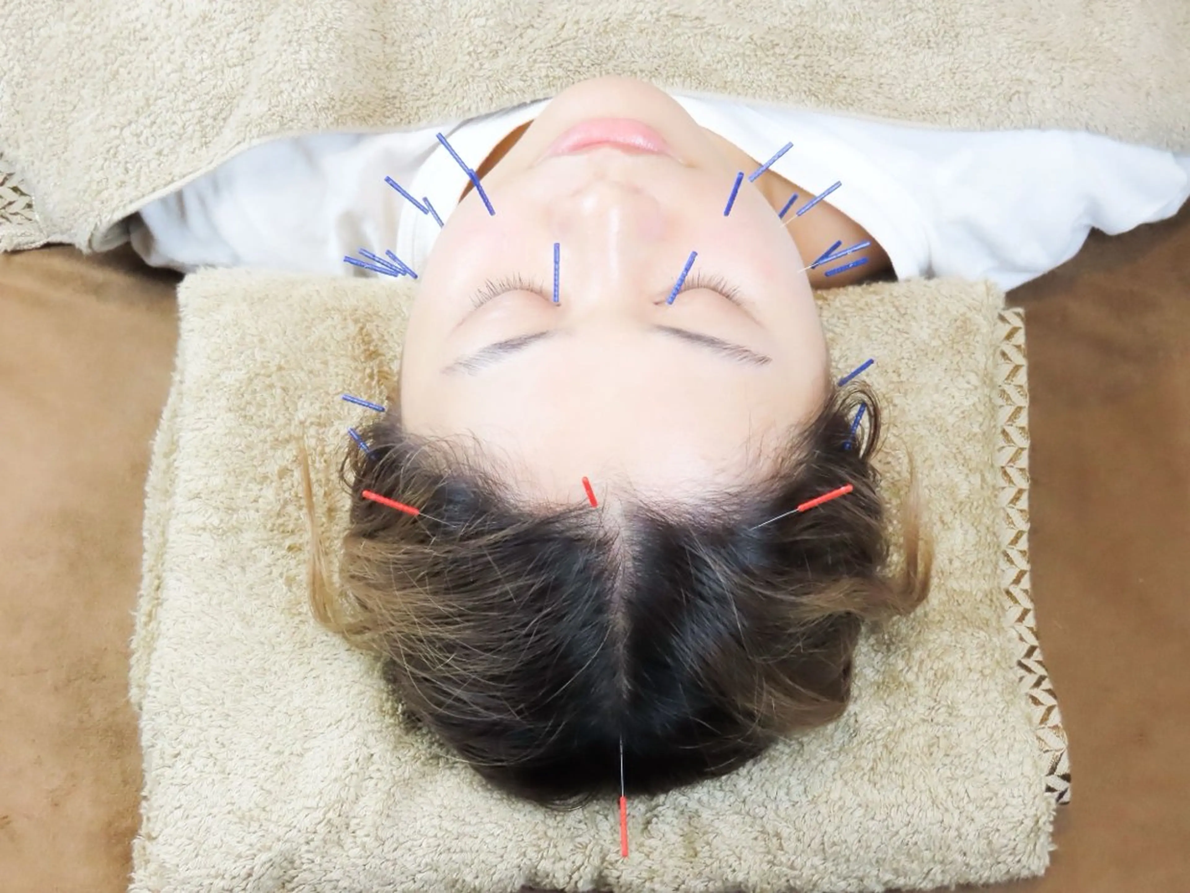 【肌質改善・リフトアップ】15種以上の技術で打つ極上美容鍼60分✨15項目分析×自律神経ケア×小顔矯正 💆‍♀️の写真