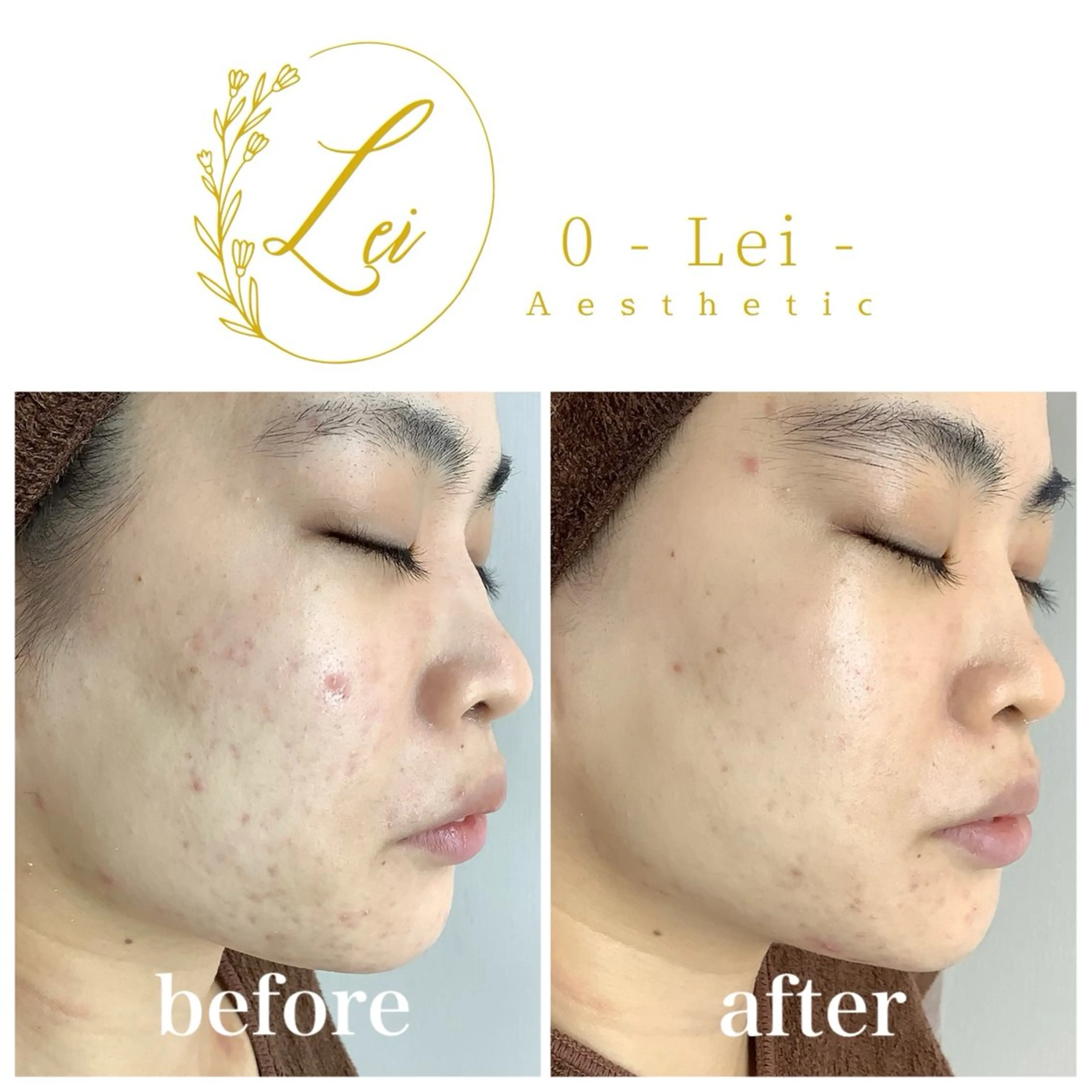 エステ 0-Lei-aesthetic所属・レイエステティック スタッフのエステ・リラクイメージ