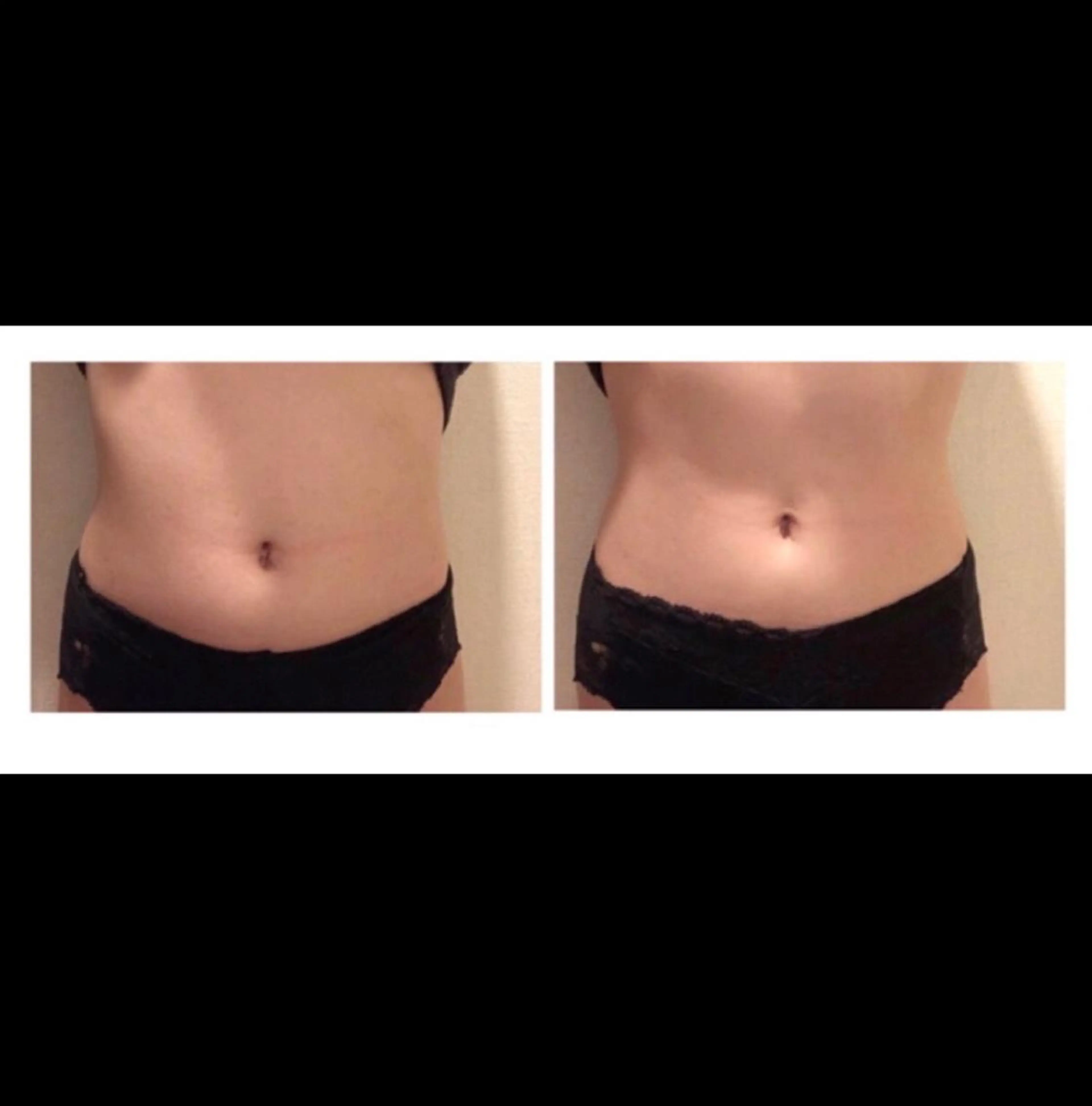 Salon Rosé 🌿漢方🌿足痩せのエステ・リラクイメージ