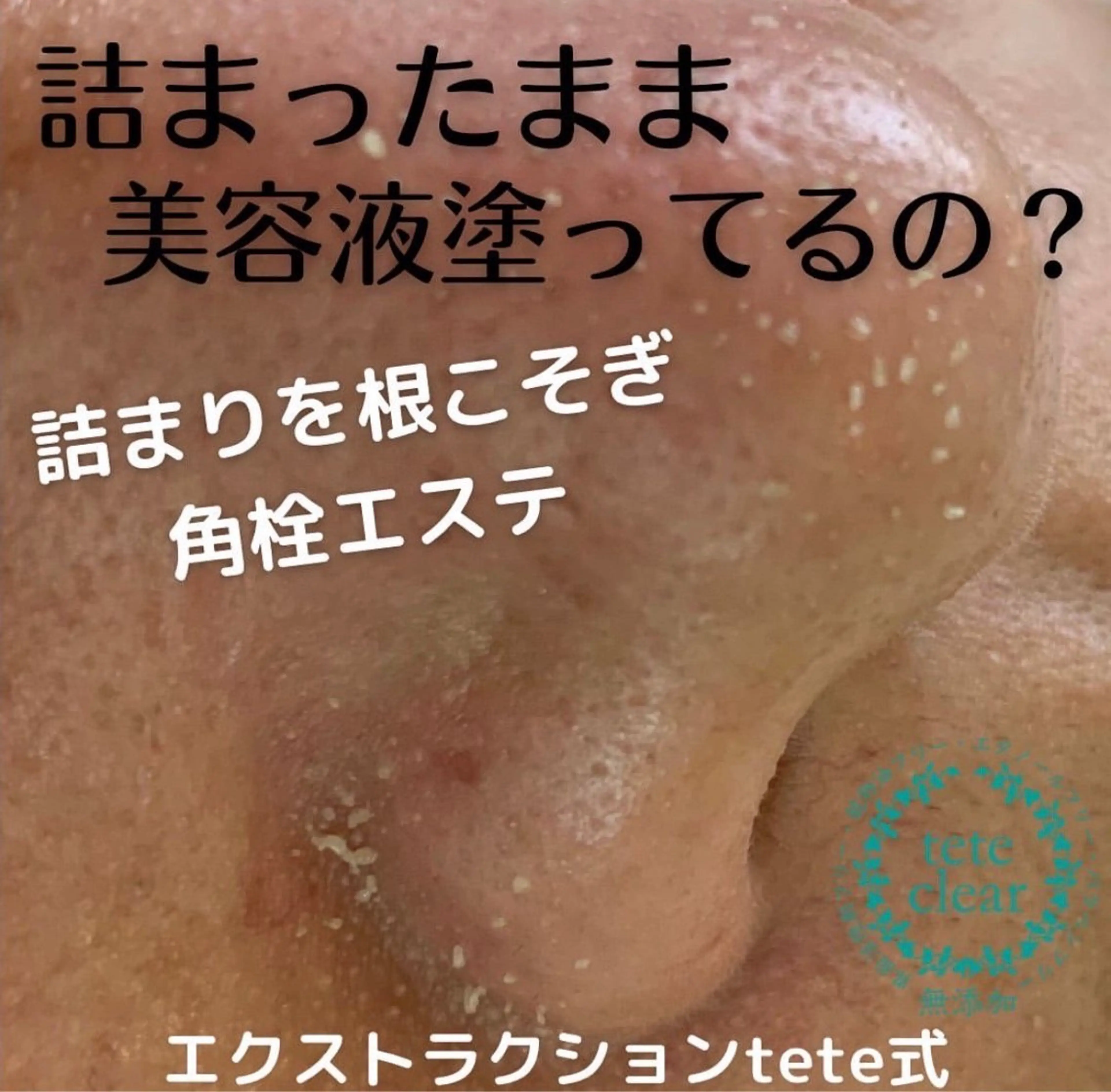 【毛穴専門店】 瑞江|yukaのエステ・リラクイメージ